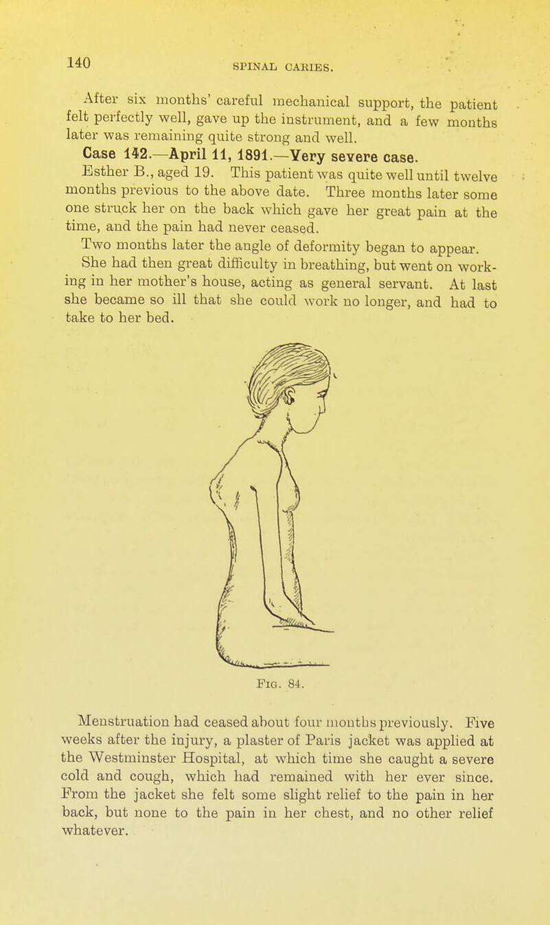 After six months' careful mechanical support, the patient felt perfectly well, gave up the instrument, and a few months later was remaining quite strong and well. Case 142.—April 11, 1891.—Yery severe case. Esther B., aged 19. This patient was quite well until twelve months previous to the above date. Three months later some one struck her on the back which gave her great pain at the time, and the pain had never ceased. Two months later the augle of deformity began to appear. She had then great difficulty in breathing, but went on work- ing in her mother's house, acting as general servant. At last she became so ill that she could work no longer, and had to take to her bed. Fig. 84. Menstruation had ceased about four months previously. Five weeks after the iujury, a plaster of Paris jacket was applied at the Westminster Hospital, at which time she caught a severe cold and cough, which had remained with her ever since. Prom the jacket she felt some slight relief to the pain in her back, but none to the pain in her chest, and no other relief whatever.