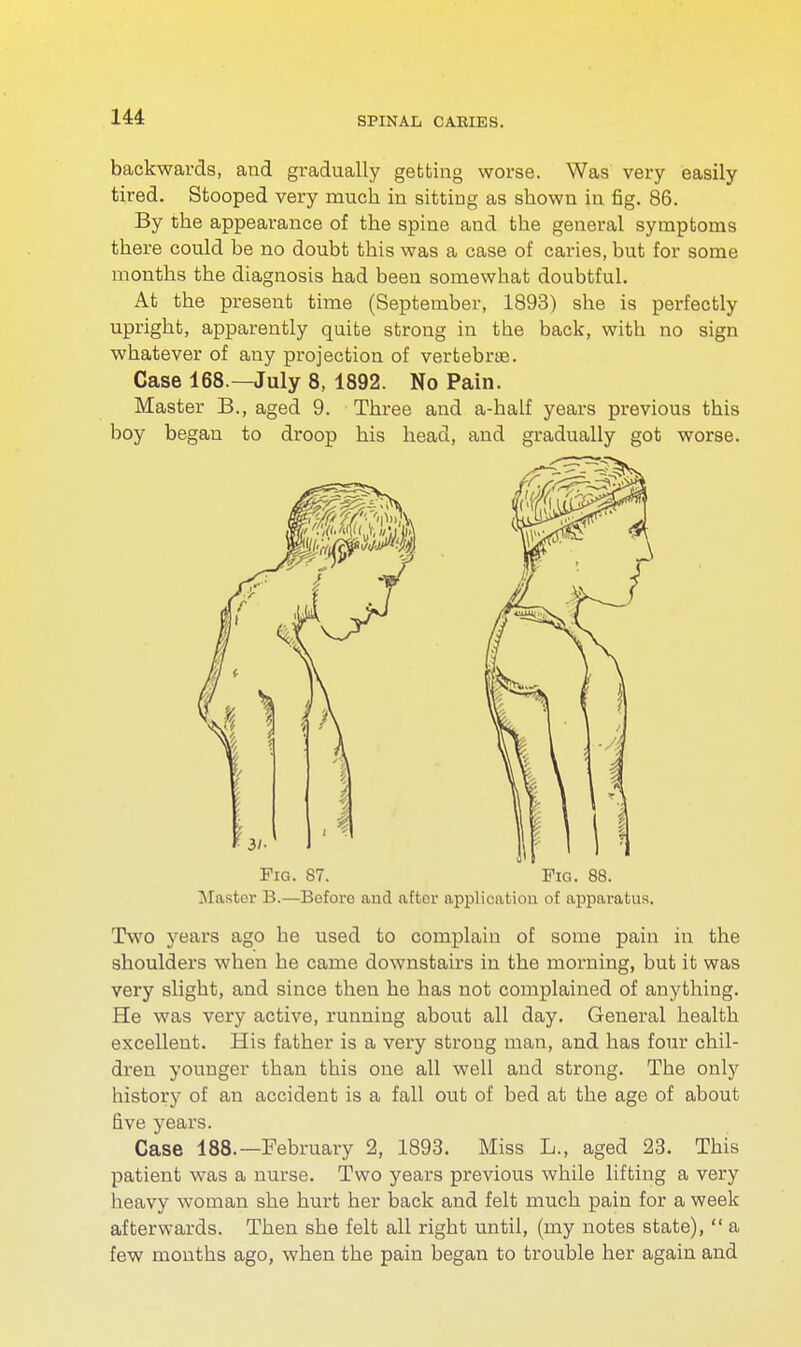 backwards, and gradually getting worse. Was very easily tired. Stooped very much in sitting as shown in fig. 86. By the appearance of the spine and the general symptoms there could be no doubt this was a case of caries, but for some months the diagnosis had been somewhat doubtful. At the present time (September, 1893) she is perfectly upright, apparently quite strong in the back, with no sign whatever of any projection of vertebrae. Case 168.—July 8, 1892. No Pain. Master B., aged 9. Three and a-half years previous this boy began to droop his head, and gradually got worse. Fig. 87. Fig. 88. Master B.—Before and after applicatiou of apparatus. Two years ago he used to complain of some pain in the shoulders when he came downstairs in the morning, but it was very slight, and since then he has not complained of anything. He was very active, running about all day. General health excellent. His father is a very strong man, and has four chil- dren younger than this one all well and strong. The only history of an accident is a fall out of bed at the age of about five years. Case 188.—February 2, 1893. Miss L., aged 23. This patient was a nurse. Two years previous while lifting a very heavy woman she hurt her back and felt much pain for a week afterwards. Then she felt all right until, (my notes state),  a few months ago, when the pain began to trouble her again and