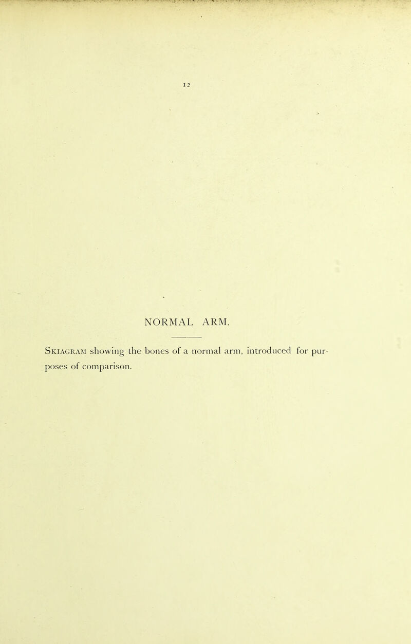 12 NORMAL ARM. Skiagram showing the bones of a normal arm, introduced for pur- poses of comparison.