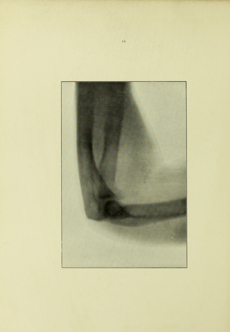 t6