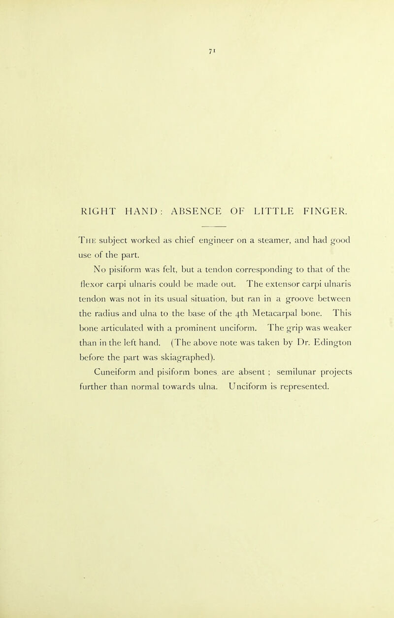 71 RIGHT HAND: ABSENCE OF LITTLE FINGER. The subject worked as chief engineer on a steamer, and had good use of the part. No pisiform was felt, but a tendon corresponding to that of the tiexor carpi ulnaris could be made out. The extensor carpi ulnaris tendon was not in its usual situation, but ran in a groove between the radius and ulna to the base of the 4th Metacarpal bone. This bone articulated with a prominent unciform. The grip was weaker than in the left hand. (The above note was taken by Dr. Edington before the part was skiagraphed). Cuneiform and pisiform bones are absent ; semilunar projects further than normal towards ulna. Unciform is represented.