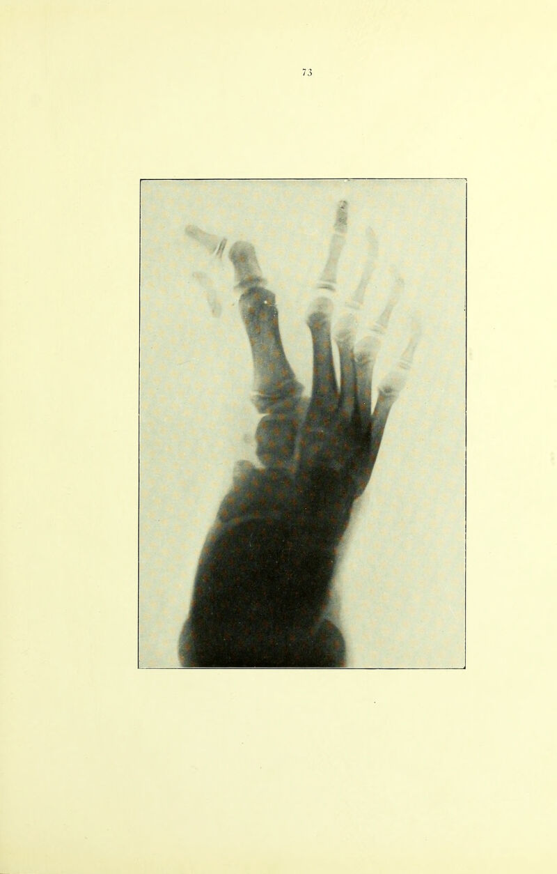 73