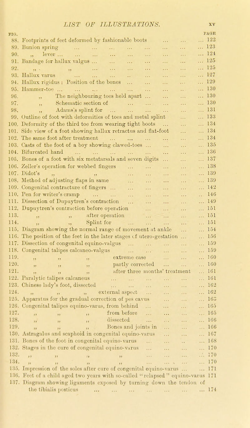 riG. PAOE S8. Footpi-ints of feet deformod by fashionable boots 122 89. Bunion spring ... ... ... ... ... ... ... ... 123 90. „ lever 121 91. Bandage i'or hallux valgus ... ... ... ... ... ... ... 125 92. „ „ 125 93. Hallux varus 127 94. Hallux rig-idus : Position of the bones 129 95. Hammer-toe ... ... ... ... ... ... ... .. ••• 130 96. „ The neighbouring toes held apart 130 97. ,, Schematic section of ... ... ... ... ... 130 98. „ Adams's splint for ... ... ... ... ... ... 131 99. Outline of foot with deformities of toes and metal splint ... ... 133 100. Deformity of the third toe from wearing tight boots 134 101. Side view of a foot showing hallux retractus and flat-foot ... ... 134 102. The same foot after treatment ... ... ... ... ... ... 134 103. Casts of the foot of a boy showing clawed-toes ... ... ... ... 135 104. Bifurcated hand 136 105. Bones of a foot with six metatarsals and seven digits ... ... ... 137 106. Zeller's operation for webbed fingers ... ... ... ... ... 138 107. Didot's „ „ 139 108. Method of adjusting flaps in same ... ... ... ... ... 139 109. Congenital contracture of fingers ... ... ... ... ... ... 142 110. Pen for writer's cramp ... ... ... ... ... ... .. 146 111. Dissection of Dupuytren's contraction ... ... ... ... ... 149 112. Dupuytren's contraction before operrition ... ... ... ... 151 113. ,, ,, after operation ... ... ... ... 151 114. „ „ Splint for 151 115. Diagram showing the normal range of movement at ankle ... ... 154 116. The position of the feet in the later stages cf utero-gestation ... ... 156 117. Dissection of congenital equino-valgus ... ... ... ... ... 159 118. Congenital talipes calcaneo-valgu.s ... ... ... ... ... 159 119. ,, ,, ,, extreme case ... ... ... 160 120. „ „ ,, partly corrected ... ... ... 160 121. ,, „ ,, after three months'treatment ... 161 122. Paralytic talipes calcaneus ... ... ... ... ... ... 161 123. Chinese lady's foot, dissected ... ... ... ... ... ... 162 124. ,, ,, „ external aspect ... ... ... ... 162 125. Apparatus for the gradual correction of pes cavus ... ... ... 163 126. Congenital talipes equino-varus, from behind ... ... ... ... 165 127. ,, ,, ,, from before 165 128. ,, ,, ,, dissected ... ... ... ... 166 129. „ ,, ,, lionos and joints in ... ... ... 166 130. Astragalus iind scaphoid in congenital equino-varus ... ... ... 167 131. Bonos of the foot in congenital equino-varus ... ... .. ... 168 132. Stages in the cure of congenital equino-varus ... ... ... ... 170 133. ,, ,, ., „ ... ... ... 170 134. „ „ „ „ 170 135. Impression of the soles after cure of congenital equino-varus ... ... 171 130. Feet of a child aged two years with so-called relapsed equino-varus 171 137. Diagram showing ligaments c.Npnscd by turning down the tendon of tlie tibialis posticus ... ... ... ... ... ... ... 174