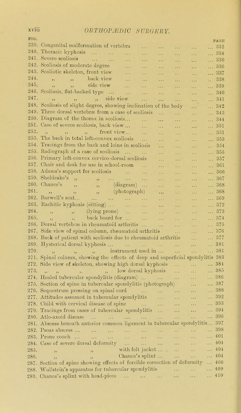 PAGE 239. Congenital malformation of vertelir.i 332 240. Thoracic kyphosis 334 241. Severe scoliosis ... ... ... 336 242. Scoliosis of moderate degree ... ... 336 243. Scoliotic skeleton, front view ... ... ... .. 337 244. ,, „ back view 338 245. „ ,, side view 339 246. Scoliosis, flat-backed type ... ... ... ... .. ... ... 340 247. ,, ,, ,, side view 341 248. Scoliosis of slight degree, showing inclination of the body 342 249. Thi-ee dorsal vertebra} from a case of scoliosis 343 250. Diagram of the thorax in scoliosis 344 251. Case of severe scoliosis, back view ... ... ... ... ... ... 351 252. „ ,, „ front view 351 253. The back in total left-convex scoliosis 353 254. Tracings from iho back and loins in scoliosis ... .. 354 255. Radiograph of a case of scoliosis ... ... ... ... ... ... 355 256. Primary left-convex cervico-dorsal scoliosis ... ... ... ... 357 257. Chair and desk for use in school-room 361 258. Adams's support for scoliosis ... ... ... ... 366 259. Sheldrake's ,, „ ... ... ... ... ... 367 260. Chance's ,, „ (diagram) 368 261. „ „ „ (photograph) 368 262. Harwell's seat 369 263. Eaohitic kyphosis (sitting) ... ... ... ... ... 372 264. ,, „ (lying prone) 373 265. „ „ back board for 374 266. Dorsal vertebra3 in rheumatoid arthritis ... ... ... ... ... 375 267. Side view of spinal column, rheumatoid arthritis ... ... ... 376 268. Back of patient with scoliosis due to rheumatoid arthritis ... ... 377 269. Hysterical dorsal kyphosis ... ... ... ... ... ... ... 381 270. ,, ,, ,, instrument used in ... ... ... ... 381 271. Spinal column, showing the effects of deep and superficial spondylitis 383 272. Side view of skeleton, showing high dorsal kyphosis ... ... ... 384 273. ,, ,, ,. ,, low dorsal kyphosis ... ... ... 385 274. Healed tubercular spondylitis (diagram) ... ... ... ... ... 386 275. Section of spine in tubercular spondylitis (photograjih) 387 276. Sequestrum pres.sing on spinal cord ... ... ... ... ... 388 277. Attitudes assumed in tubercular spondylitis ... ... ... ... 392 278. Child with cervical disease of .spine ... ... ... ... ... 393 279. Tracings from cases of tubercular spondylitis ... ... ... ... 394 280. Atlo-axoid disease 396 281. Abscess beneath anterior common ligament in tubercular spondylitis... 397 282. Tsoas abscess 398 283. Prone couch 401 284. Case of severe dorsal defonnity 404 285. „ „ with felt .jacket 404 286. ,, ,, Chance's splint 404 287. Section of spine showing effects of forcible correction of deformity ... 400 288. WuUstein's api)arutus for tubercular spondylitis 409 289. Chance's 8i)lint with head-piece 410