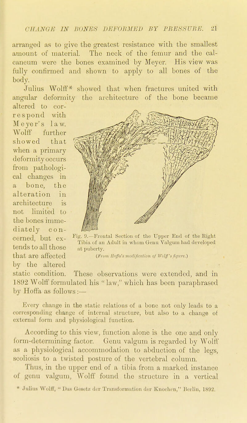 arranged as to give tlie greatest resistance with the smallest amount of material. The neck of the femur and the cal- caneura were the bones examined by Meyer. His view was fully confirmed and shown to apply to all bones of the body. Julius Wolff ^' showed that when fractures united with angular deformity the architecture of the bone became altered to cor- respond with Meyer's law. Wolff further showed that when a primary deformity occurs from pathologi- cal chanoes in a bone, the alteration in architecture is not limited to the bones imme- diately con- cerned, but ex- tends to all those that are affected by the altered static condition. These observations were extended, and in 1892 Wolff formulated his law, which has been paraphrased by Hoff'a as follows:— Every change in the static reIation.s of a bone not only leads to a corresponding change of internal structure, but also to a change of external form and phy.siological function. According to this view, function alone is the one and only form-determining factor. Genu valgum is regarded by Wolff as a physiological accommodation to abduction of the legs, scoliosis to a twisted posture of the vertebral column. Thu.s, in the upper end of a tibia from a jnarked instance of genu valgum, Wolff found the structure in a vertical Fii;-. 9.—Froutal Section of the Upper Eud of tlie Riglit Tibia of au Adult iu wlioin Geuu Valgum had developed at puberty. (From Hnffa's moilificalion oj Wolff's fujurc.) * Julius Wolff,  Das Gosoti! der Tninafonnation dor Knoclun, Horlin, 1892.