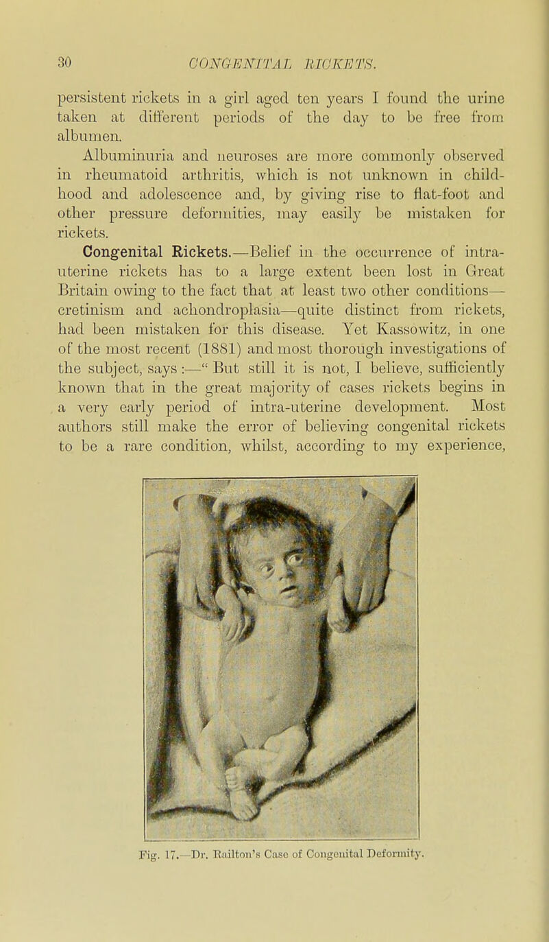 persistent rickets in a girl aged ten yeai-s I found the urine taken at different periods of the day to be free from albumen. Albuminuria and neuroses are more commonly observed in rheumatoid arthritis, which is not unknown in child- hood and adolescence and, by giving rise to flat-foot and other pressure deformities, may easily be mistaken for rickets. Congenital Rickets.—Belief in the occurrence of intra- uterine rickets has to a large extent been lost in Great Britain owing to the fact that at least two other conditions— cretinism and achondroplasia—quite distinct from rickets, had been mistaken for this disease. Yet Kassowitz, in one of the most recent (1881) and most thorough investigations of the subject, says :— But still it is not, I believe, sufficiently known that in the great majority of cases rickets begins in a very early period of intra-uterine development. Most authors still make the error of believing congenital rickets to be a rare condition, whilst, according to my experience, Fig. 17.—Dr. Eailton's Case of Coiigoiiital Defonuit.y.
