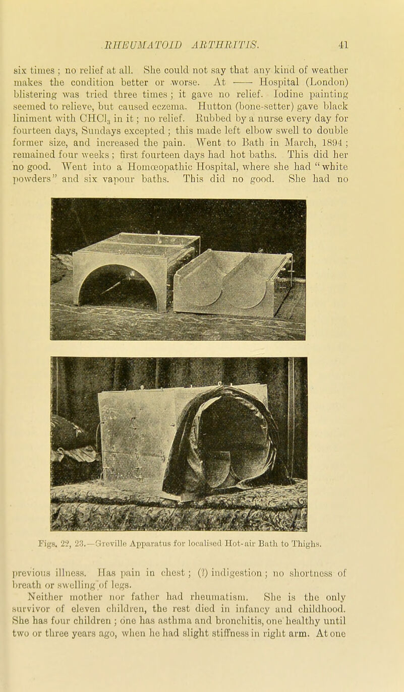 six times ; no relief at all. She could not say that any kind of weather makes the condition better or Avorse. At -—- Hospital (London) blistering was tried three times ; it gave no relief. Iodine painting seemed to relieve, but caused eczema. Hutton (bone-setter) gave black liniment with CHClj in it; no relief. Rubbed by a nurse every day for fourteen days, Sundays excepted ; this made left elbow swell to double former size, and increased the pain. Went to Bath in March, 18!)4 ; remained four weeks ; first fourteen days had hot baths. This did her no good. Went into a Homoeopathic Hospital, where she had white powders and six vapour baths. This did no good. She had no Figs. 2'2, 23.—Greville Apparatus for localised Hot-air Batli to Thighs. |)revious illness. Has pain in chest; (1) indigestion ; no .shortness of breath or swelling/jf legs. Neither mother nor father had rheumatism. She is the only .survivor of eleven children, the rest died in infancy and childhood. She has four children ; one has asthma and bronchitis, one healthy until two or three years ago, when he had slight stiffness in right arm. At one