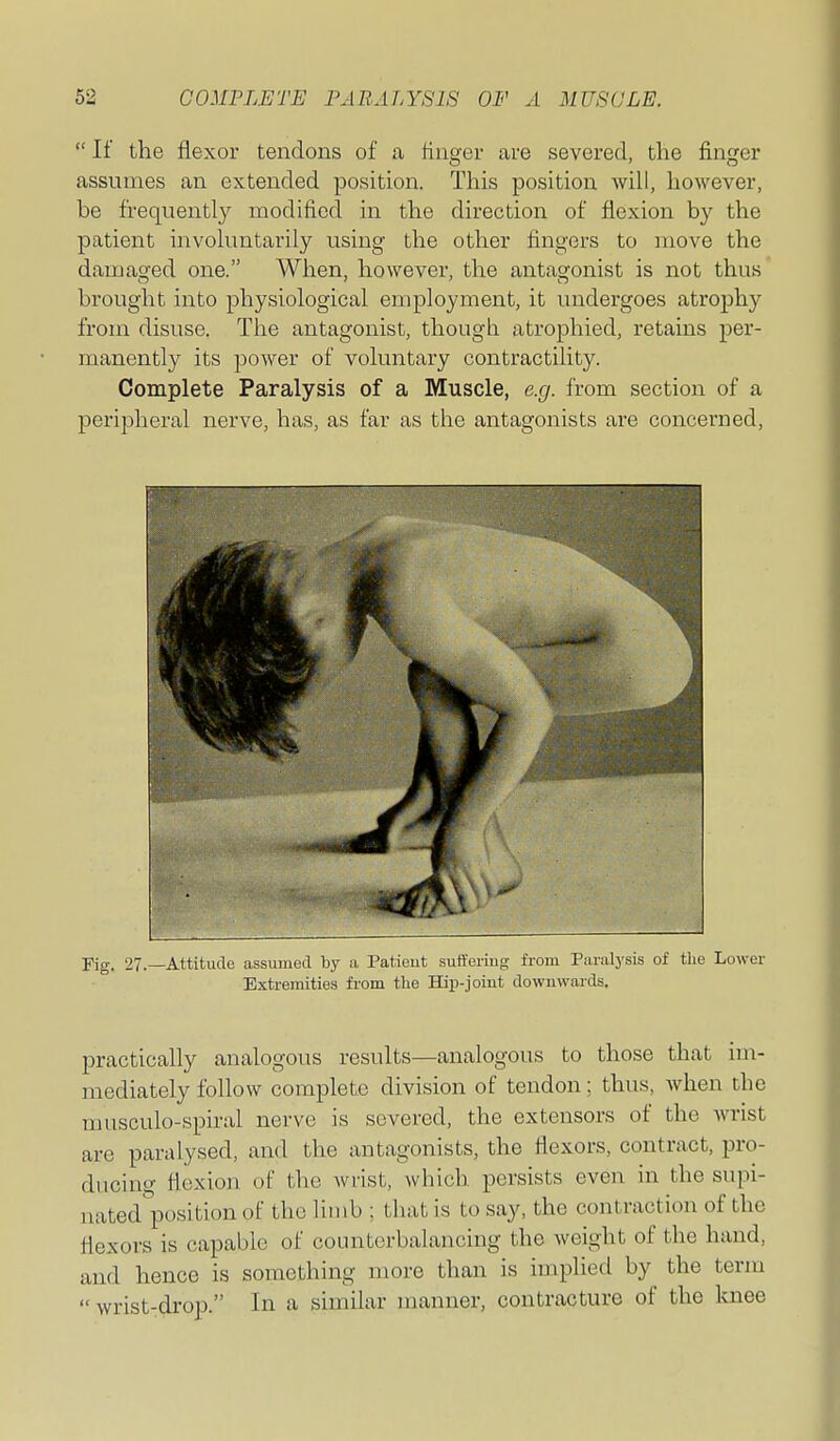  If the flexor tendons of a finger are severed, the finger assumes an extended position. This position will, however, be frequently modified in the direction of flexion by the patient invokmtarily using the other fingers to move the damasked one. When, however, the antasronist is not thus brought into physiological employment, it undergoes atrophy from disuse. The antagonist, though atrophied, retains per- manently its power of voluntary contractility. Complete Paralysis of a Muscle, e.g. from section of a peripheral nerve, has, as far as the antagonists are concerned. Fig. 27.—Attitudu iissuined by n, Patieut sutferiug from Paralysis of the Lower Extremities from the Hip-joint downwards. practically analogous results—analogous to those that im- mediately follow complete division of tendon; thus, when the musculo-spiral nerve is severed, the extensors of the wrist are paralysed, and the antagonists, the flexors, contract, pro- dncino- flexion of the wrist, which persists even in the supi- nated'position of the limb ; that is to say, the contraction of the flexors is capable of counterbalancing the weight of the hand, and hence is something more than is implied by the term  wrist-drop. In a similar inanner, contracture of the knee