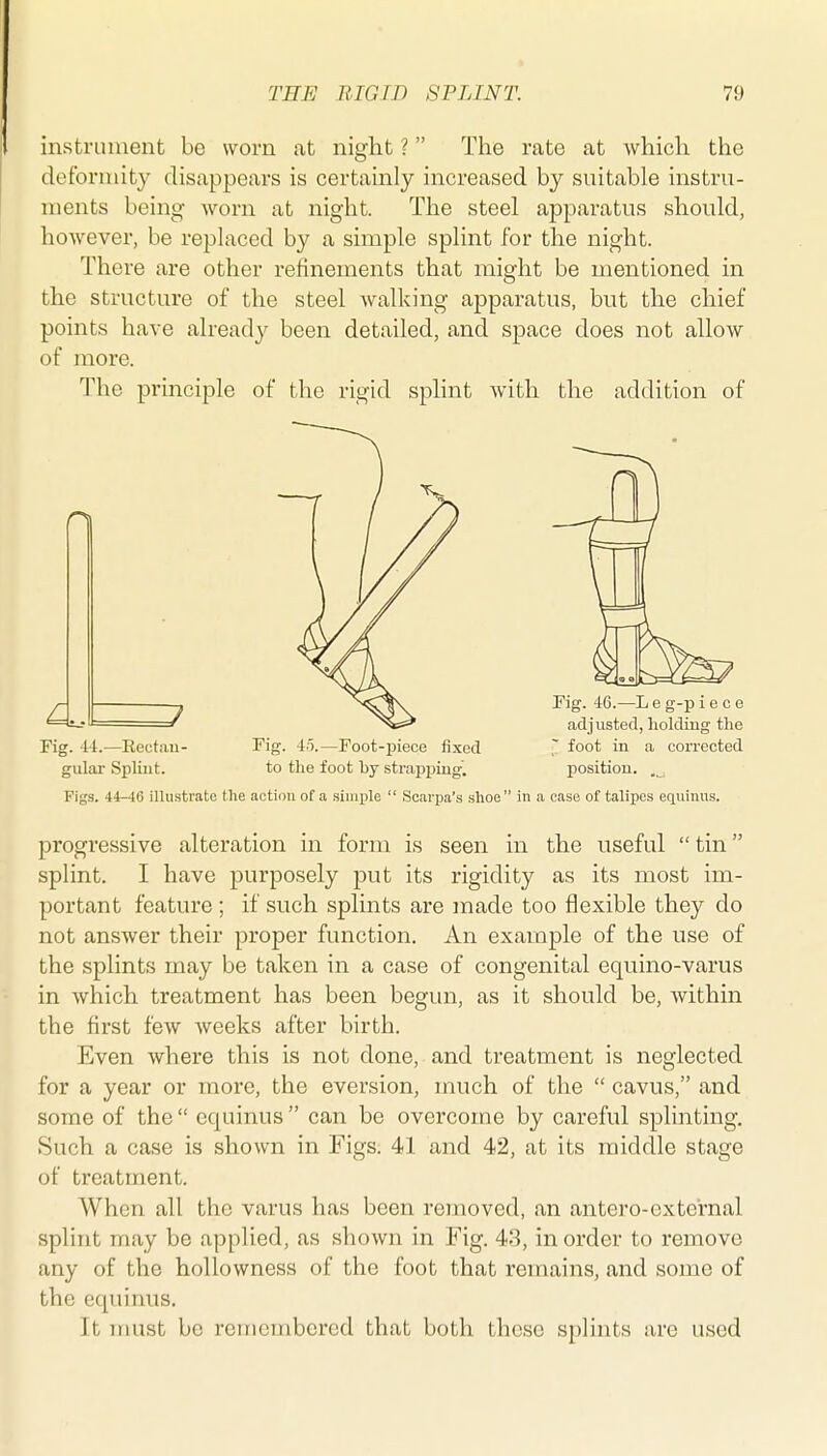 instruuient be worn at night ? The rate at which the deformity disappears is certainly increased by suitable instru- ments being worn at night. The steel apparatus should, however, be replaced by a simple splint for the night. There are other refinements that might be mentioned in the structure of the steel walking apparatus, but the chief points have already been detailed, and space does not allow of more. The principle of the rigid splint with the addition of Fig. 44.—Eectau- Fig. 45.—Foot-i)iece fixed T foot in ^ corrected gulai- Splint. to the foot by strapping^ position. . Figs. 44-46 illustrate the action of a simijle  Scarpa's shoe in a case of talipes equinus. progressive alteration in form is seen in the useful  tin splint. I have purposely put its rigidity as its most im- portant feature ; if such splints are made too flexible they do not answer their proper function. An exarQple of the use of the splints may be taken in a case of congenital equino-varus in which treatment has been begun, as it should be, within the first few weeks after birth. Even where this is not done, and treatment is neglected for a year or more, the eversion, much of the  cavus, and some of the  equinus  can be overcome by careful splinting. Such a case is shown in Figs. 41 and 42, at its middle stage of treatment. When all the varus has been removed, an antero-external splint may be applied, as shown in Fig. 43, in order to remove any of the hollowness of the foot that remains, and some of the equinus. It nmst be remembered that both these splints are used