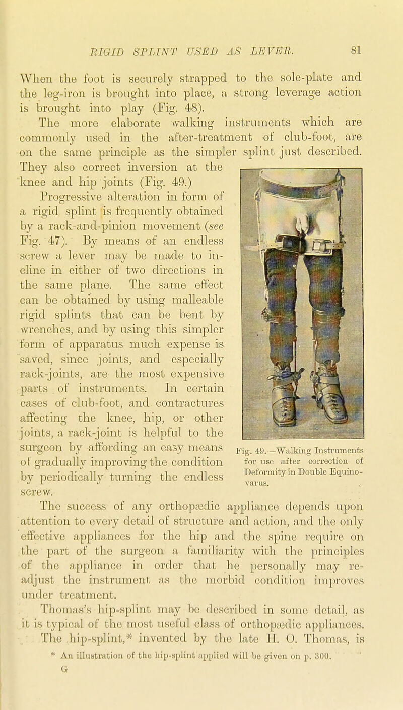 When the foot is securely strapped to the sole-pliite and the leg-iron is brought into place, a strong leverage action is brought into play (Fig. 48). The more elaborate walking instruments which are commonly used in the after-treatment of club-foot, are on the same principle as the simpler splint just described. They also correct inversion at the knee and hip joints (Fig. 49.) Pro'ressive alteration in form of a rigid splint is frequently obtamed by a rack-and-pinion movement {sec Fig. 47). By means of an endless screw a lever may be made to in- cline in either of two directions in the same plane. The same effect can be obtained by using malleable rigid splints that can be bent by wrenches, and by using this simpler form of apparatus much expense is saved, since joints, and especially rack-joints, are the most expensive parts of instruments. In certain cases of club-foot, and contractures affecting the knee, hip, or other joints, a rack-joint is helpful to the surgeon by affording an easy means ot gradually improving the condition by periodically turning the endless screw. The success of any orthopaidic appHance depends upon attention to every detail of structure and action, and the only effective appliances for the hip and ihc spine require on the part of the surgeon a familiarity with the principles of the appliance in order that ho personally may re- adjust the instrument as the morbid condition improves under treatment. Thomas's hip-splint may be described in some detail, as it is typical of the most useful class of orthop;edic appliances. The hip-splint,* invented by the late H. 0. Thomas, is * An illiistratioii of tho liip-.spliiit applied will be given on p. 300. a Fig. 49.—Walking Instruments for use after coiTectiou of Deformity iu Double Equiiio- varus.