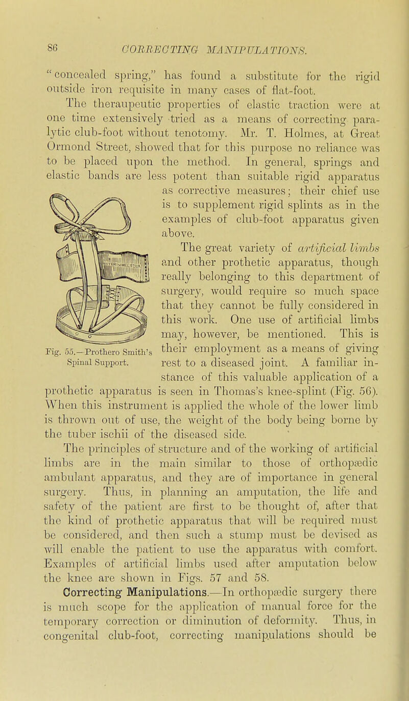 GOBREGTING MANIPULATIONS. concealed spring, has found a substitute for the rigid outside iron requisite in many cases of flat-foot. The theraupeutic properties of elastic traction were at one time extensively tried as a means of correcting jDara- lytic club-foot without tenotomy. Mr. T. Holmes, at Great Orraond Street, showed that for this purpose no reliance was to be placed upon the method. In general, springs and elastic bands are less potent than suitable rigid apparatus as corrective measures; their chief use is to supplement rigid splints as in the examples of club-foot apparatus given above. The great variety of artificial limbs and other prothetic apparatus, though really belonging to this department of surgery, would require so much space that they cannot be fully considered in this work. One use of artificial limbs may, however, be mentioned. This is their employment as a means of giving rest to a diseased joint. A familiar in- stance of this valuable application of a prothetic apparatus is seen in Thomas's knee-splint (Fig. 56). When this instrument is applied the whole of the lower limb is thrown out of use, the weight of the body being borne by the tuber ischii of the diseased side. The principles of structure and of the working of artificial limbs are in the main similar to those of orthopajdic ambulant apparatus, and they are of importance in general surgery. Thus, in planning an amputation, the life and safety of the patient are first to be thought of, after that the kind of prothetic apparatus that will be required must be considered, and then such a stump must be devised as will enable the patient to use the apparatus with comfort. Examples of artificial limbs used after amputation below the knee arc shown in Figs. 57 and 58. Correcting Manipulations.—In orthoptedic surgery there is much scope for the application of manual force for the temporary correction or diminution of deformity. Thus, in congenital club-foot, correcting manipulations should be Fig. 55.—Prothero Smith's S^jiual Support.