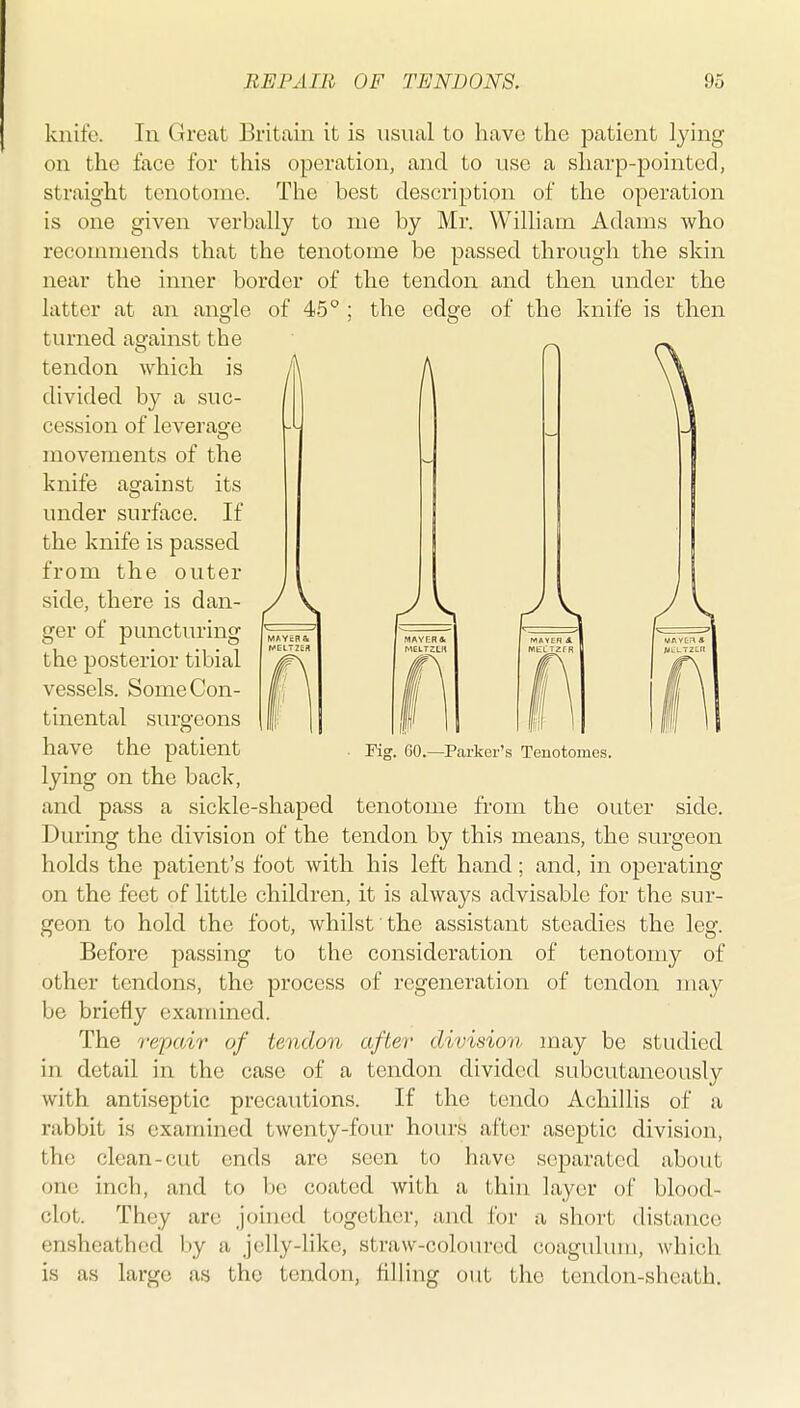 knife. In Great Britain it is usual to have the patient lying on the face for this operation, and to use a sharp-pointed, straight tenotome. The best description of the operation is one given verbally to me by Mr. William Adams who recommends that the tenotome be passed through the skin near the inner border of the tendon and then under the latter at an angle of 45 ; the edge of the knife is then turned against the tendon which is divided by a suc- cession of leverage movements of the knife against its under surface. If the knife is passed from the outer side, there is dan- ger of puncturing the posterior tibial vessels. Some Con- tinental surgeons have the patient lying on the back, and pass a sickle-shaped tenotome from the outer side. During the division of the tendon by this means, the surgeon holds the patient's foot with his left hand; and, in operating on the feet of little children, it is always advisable for the sur- geon to hold the foot, whilst the assistant steadies the leg. Before passing to the consideration of tenotomy of other tendons, the process of regeneration of tendon may be briefly examined. The repair of tendon after division may be studied in detail in the case of a tendon divided subcutaneously with antiseptic precautions. If the tendo Achillis of a rabbit is examined twenty-four hours after aseptic division, the clean-cut ends are seen to have separated about one inch, and to be coated with a thin layer of blood- clot. They are joined together, and for a short distance ensheathed by a jelly-like, straw-coloured coagulum, which is as large as the tendon, filling out the tendon-sheath. Fig. 60.—Parker's Tenotomes.