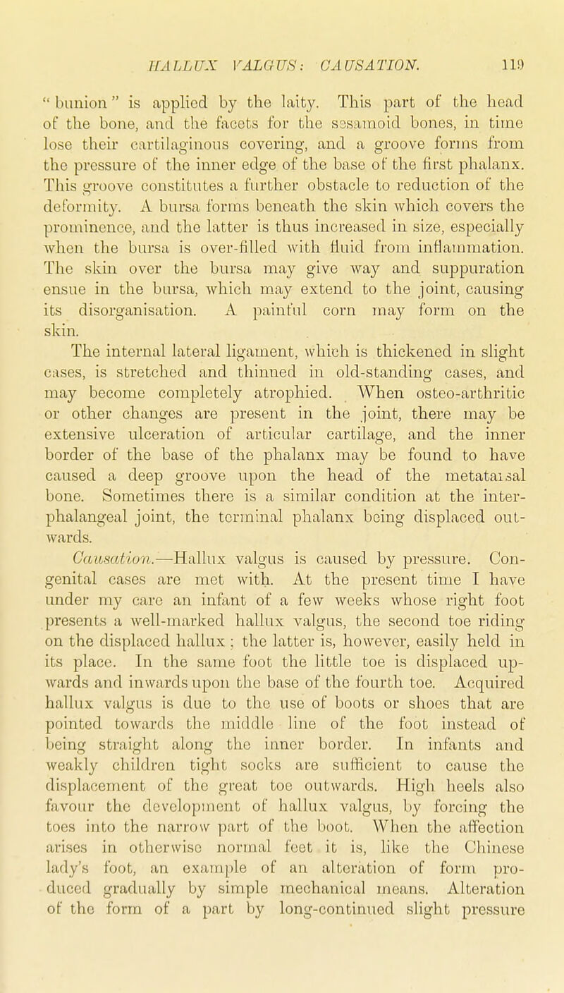  bunion is applied by the lait}'. This part of the head of the bone, and the facets for the sssamoid bones, in time lose their cartihxginous covering, and a groove forms from the pressure of the inner edge of the base of the first phalanx. This groove constitutes a further obstacle to reduction of the deformity. A bursa forms beneath the skin which covers the prominence, and the latter is thus increased in size, especially when the bursa is over-filled with fluid from infiammation. The skin over the bursa may give way and suppuration ensue in the bursa, which may extend to the joint, causing its disorganisation. A painful corn may form on the skin. The internal lateral ligament, which is thickened in slight cases, is stretched and thinned in old-standing cases, and may become completely atrophied. When osteo-arthritic or other changes are present in the joint, there may be extensive ulceration of articular cartilage, and the inner border of the base of the phalanx may be found to have caused a deep groove upon the head of the metataisal bone. Sometimes there is a similar condition at the inter- phalangeal joint, the tcnnhial phalanx being displaced out- wards. Causation.—Hallux valgus is caused by pressure. Con- genital cases are met with. At the present time I have under my care an infimt of a few weeks whose right foot presents a well-marked hallux valgus, the second toe riding on the displaced hallux ; the latter is, however, easil)^ held in its place. In the same foot the little toe is displaced up- wards and inwards upon the base of the fourth toe. Acquired hallux valgus is due to the use of boots or shoes that are pointed towards the middle line of the foot instead of being straight along the inner border. In infixnts and weakly children tight socks are sufficient to cause the displacement of the great toe outwards. High heels also favour the development of hallux valgus, by forcing the toes into the narrow part of the boot. When the aifection arises in otherwise normal feet it is, like the Chinese lady's foot, an example of an alteration of form pro- duced gradually by simple mechanical means. Alteration of the form of a part by long-continued slight pressure