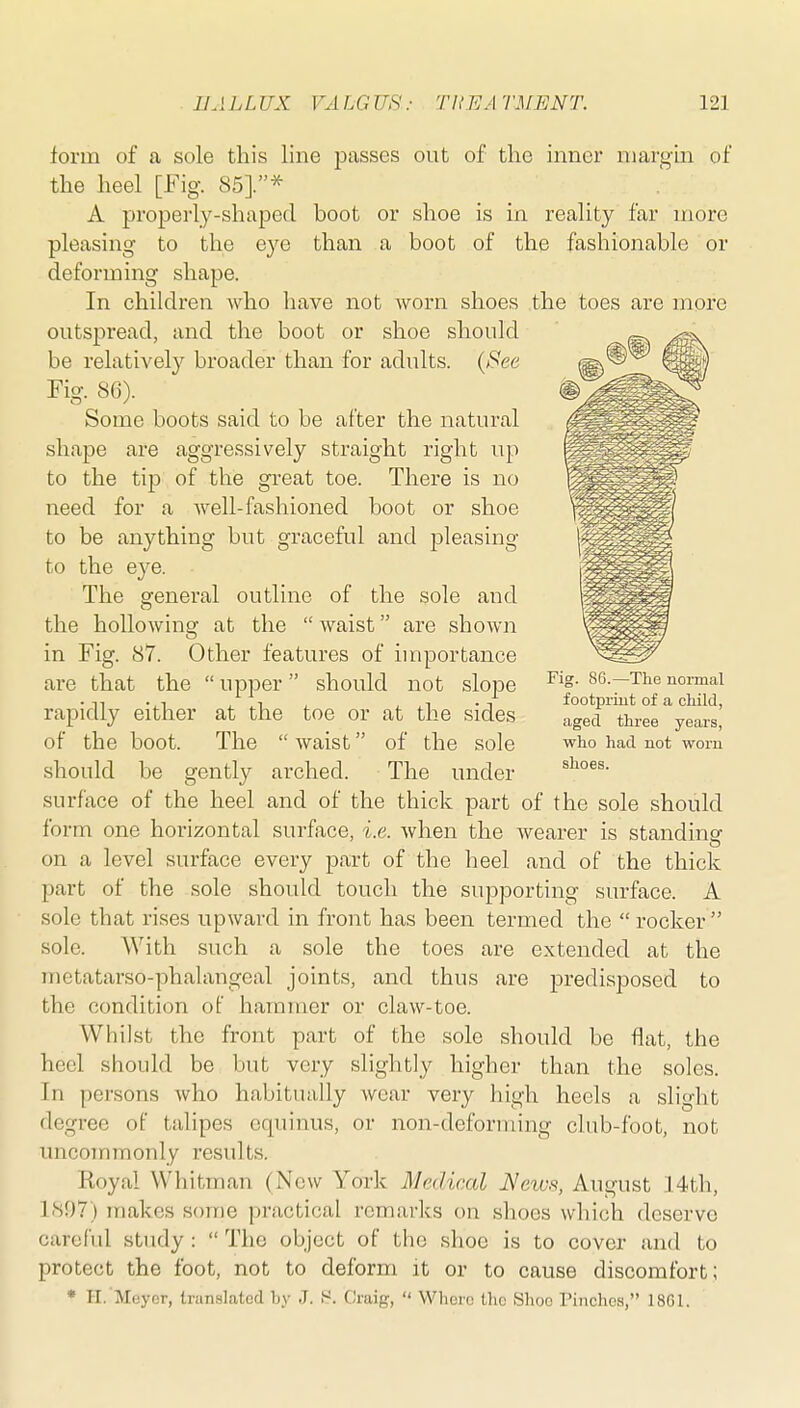 form of a sole this line passes out of the inner margin of the heel [Fig. 85].* A properly-sha|)ed boot or shoe is in reality far more pleasing to the eye than a boot of the fashionable or deforming shape. In children who have not worn shoes .the toes are more outspread, and the boot or shoe should be relatively broader than for adults. {See Fig. 86). Some boots said to be after the natural shape are aggressively straight right up to the tip of the great toe. There is no need for a well-fashioned boot or shoe to be anything but graceful and pleasing to the eye. The general outline of the sole and the hollowing at the  waist are shown in Fig. 87. Other features of importance are that the  upper should not sIojdc rapidly either at the toe or at the sides of the boot. The  waist of the sole should be gently arched. The under surface of the heel and of the thick part of the sole should form one horizontal surface, i.e. when the wearer is standing on a level surface every part of the heel and of the thick part of the sole should touch the supporting surface. A sole that rises upward in front has been termed the  rocker  sole. With such a sole the toes are extended at the metatarso-phalangeal joints, and thus are predisposed to the condition of hammer or claw-toe. Whilst the front part of the sole should be flat, the heel should be but very slightly higher than the soles. In persons who habitually wear very high heels a slight degree of talipes equinus, or non-deforming club-foot, not uncommonly results. Royal Whitman (New York Medical News, August 14th, 189?) makes some practical remarks on shoes which deserve careful study :  The object of the shoe is to cover and to protect the foot, not to deform it or to cause discomfort; * H. Meyer, Irunslatod by J. !-'. Craig,  Where tlic Shoo riiiches, 18G1. Fig. 86.—The normal footpriut of a child, aged three years, who had not worn shoes.
