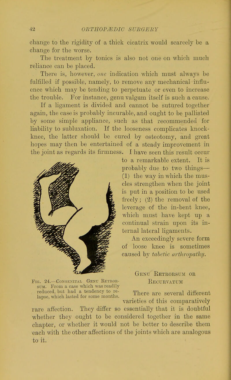 change to the rigidity of a thick cicatrix would scarcely be a change for the worse. The treatment by tonics is also not one on which much reliance can be placed. There is, however, one indication which must always be fulfilled if possible, namely, to remove any mechanical influ- ence which may be tending to perpetuate or even to increase the trouble. For instance, genu valgum itself is such a cause. If a ligament is divided and cannot be sutured together again, the case is probably incurable, and ought to be palliated by some simple appliance, such as that recommended for liability to subluxation. If the looseness complicates knock- knee, the latter should be cured by osteotomy, and great hopes may then be entertained of a steady improvement in the joint as regards its firmness. I have seen this result occur rare affection. They differ so essentially that it is doubtful whether they ought to be considered together in the same chapter, or whether it would not be better to describe them each with the other affections of the joints which are analogous to it. to a remarkable extent. It is probably due to two thmgs— (1) the way m which the mus- cles strengthen when the joint is put in a position to be used freely; (2) the removal of the leverage of the in-bent knee, which must have kept up a continual strain upon its in- ternal lateral ligaments. An exceedingly severe form of loose knee is sometimes caused by tabetic artliroioathy. Fig. 24.—Congenital Genu Eeteok- SUM. From a case which was readily reduced, but had a tendency to re- lapse, which lasted for some months. Genu Eetroksum or Eecurvatum There are several different varieties of this comparatively