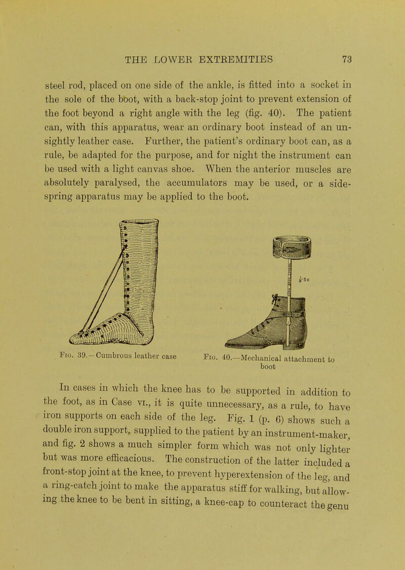 steel rod, placed on one side of the ankle, is fitted into a socket in the sole of the boot, with a back-stop joint to prevent extension of the foot beyond a right angle with the leg (fig. 40). The patient can, with this apparatus, wear an ordinary boot instead of an un- sightly leather case. Further, the patient's ordinary boot can, as a rule, be adapted for the purpose, and for night the instrument can be used with a light canvas shoe. When the anterior muscles are absolutely paralysed, the accumulators may be used, or a side- spring apparatus may be applied to the boot. Fig. 39.-Cumbrous leather case Fig. 40.—Mechanical attachment to boot In cases in which the knee has to be supported in addition to the foot, as in Case vi., it is quite unnecessary, as a rule, to have iron supports on each side of the leg. Fig. 1 (p. 6) shows such a double iron support, supplied to the patient by an instrument-maker, and fig. 2 shows a much simpler form which was not only lighter but was more efficacious. The construction of the latter included a front-stop joint at the knee, to prevent hyperextension of the leg, and a ring-catch joint to make the apparatus stiff for walking, but allow- ing the knee to be bent in sitting, a knee-cap to counteract the genu