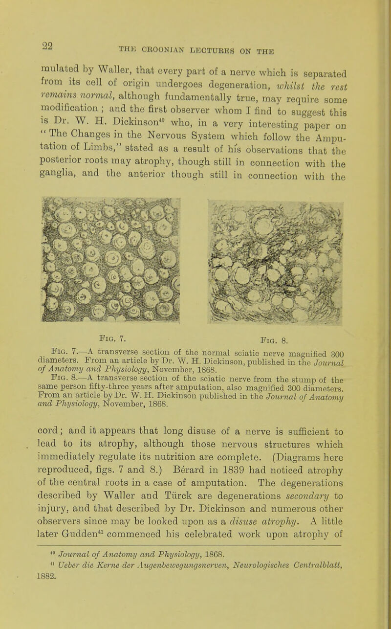 THE CKOONIAN LECTURES ON THE mutated by Waller, that every part of a nerve which is separated from its cell of origin undergoes degeneration, whilst the rest remains normal, although fundamentally true, may require some modification ; and the first observer whom I find to suggest this is Dr. W. H. Dickinson40 who, in a very interesting paper on  The Changes in the Nervous System which follow the Ampu- tation of Limbs, stated as a result of his observations that the posterior roots may atrophy, though still in connection with the ganglia, and the anterior though still in connection with the mm- Fig. 7. Fig. 8. Fig. 7.—A transverse section of the normal sciatic nerve magnified 300 diameters. From an article by Dr. W. H. Dickinson, published in the Journal of Anatomy and Physiology, November, 1868. Fig. 8.—A transverse section of the sciatic nerve from the stump of the same person fifty-three years after amputation, also magnified 300 diameters. From an article by Dr. W. H. Dickinson published in the Journal of Anatomy and Physiology, November, 1868. cord; and it appears that long disuse of a nerve is sufficient to lead to its atrophy, although those nervous structures which immediately regulate its nutrition are complete. (Diagrams here reproduced, figs. 7 and 8.) Berard in 1839 had noticed atrophy of the central roots in a case of amputation. The degenerations described by Waller and Tiirck are degenerations secondary to injury, and that described by Dr. Dickinson and numerous other observers since may be looked upon as a disuse atrophy. A little later Gudden41 commenced his celebrated work upon atrophy of 10 Journal of Anatomy and Physiology, 1868. 11 Ueber die Kerne der Augenbetvegungsnerven, Neurologisches Centralblatt, 1882.