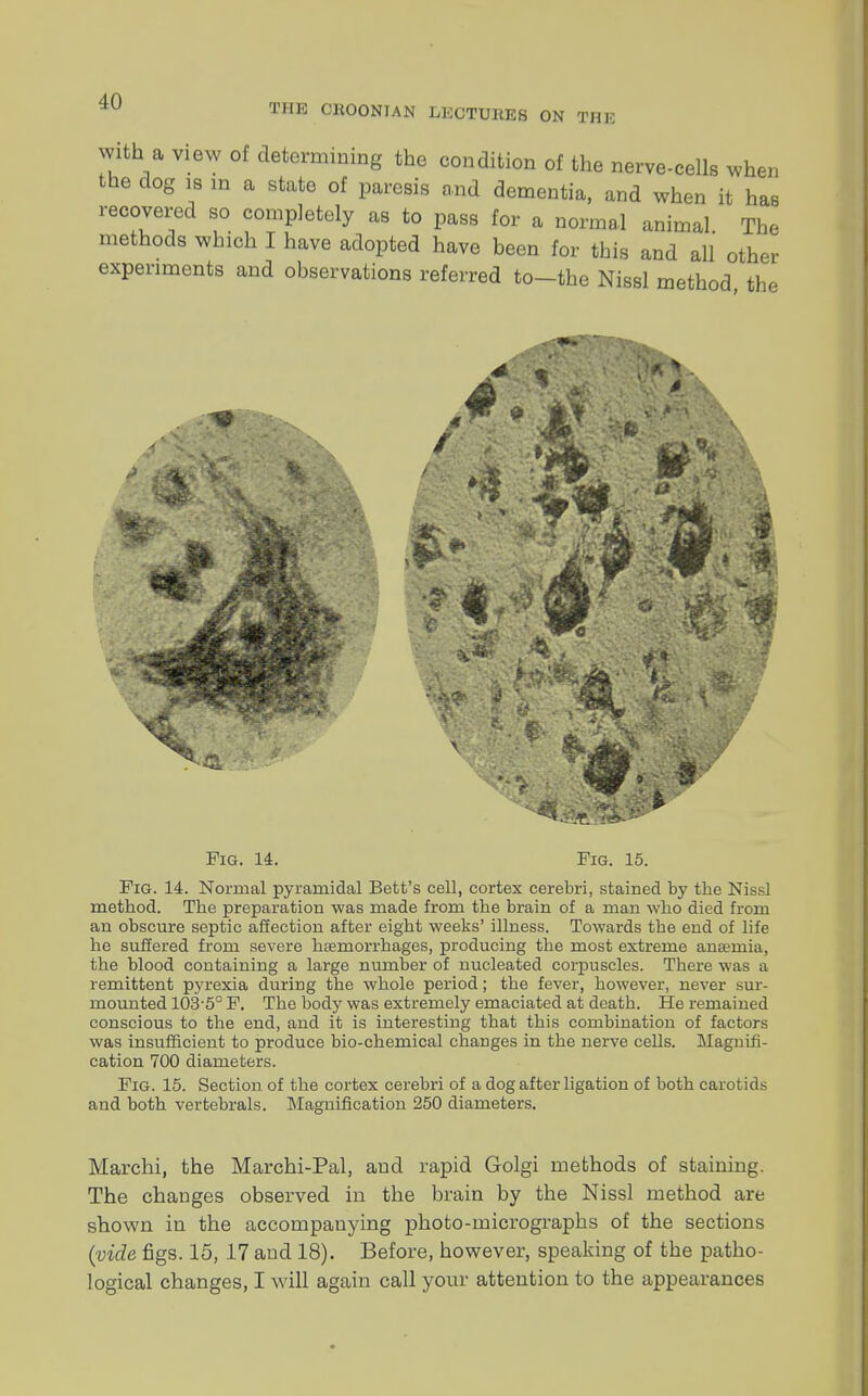 THE CKOONIAN LECTUltES ON THE with a view of determining the condition of the nerve-cells when the dog 19 in a state of paresis and dementia, and when it has recovered so completely as to pass for a normal animal The methods which I have adopted have been for this and all other experiments and observations referred to-the Nissl method the Fig. 14. Fig. 15. Fig. 14. Normal pyramidal Bett's cell, cortex cerebri, stained by tbe Nissl method. Tbe preparation was made from tbe brain of a man who died from an obscure septic affection after eight weeks' illness. Towards tbe end of life he suffered from severe hemorrhages, producing the most extreme anaemia, the blood containing a large number of nucleated corpuscles. There was a remittent pyrexia during the whole period; the fever, however, never sur- mounted 103-5° F. Tbe body was extremely emaciated at deatb. He remained conscious to tbe end, and it is interesting that this combination of factors was insufficient to produce bio-chemical changes in the nerve cells. Magnifi- cation 700 diameters. Fig. 15. Section of the cortex cerebri of a dog after ligation of both carotids and both vertebrals. Magnification 250 diameters. Marchi, the Marchi-Pal, and rapid Golgi methods of staining. The changes observed in the brain by the Nissl method are shown in the accompanying photo-micrographs of the sections (vide figs. 15, 17 and 18). Before, however, speaking of the patho- logical changes, I will again call your attention to the appearances
