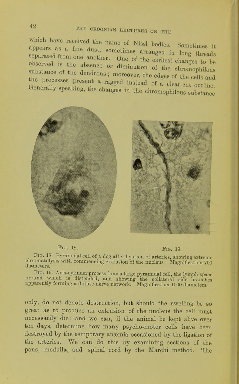 4l> THE CllOONUN LECTUHER ON THE which have received the name of Nissl bodies. Sometimes it appears as a fine dust, sometimes arranged ia Z thread separated from one another. One of the earliest chal to be observed 18 the absence or diminution of the ESuta substance of the dendrons ; moreover, the edges of the cells and the processes present a ragged instead of a clear-c t outZ Generally speakmg, the changes in the chromophilous substance I Fig. 18. Fig. 19. Fig. 18. Pyramidal cell of a dog after ligation of arteries, showing extreme chromatolysis with commencing extrusion of the nucleus. Magnification 700 diameters. Fig. 19. Axis-cylinder process from a large pyramidal cell, the lymph space around which is distended, and showing the collateral side branches apparently forming a diffuse nerve network. Magnification 1000 diameters. only, do not denote destruction, but should the swelling be so great as to produce an extrusion of the nucleus the cell must necessarily die; and we can, if the animal be kept alive over ten days, determine how many psycho-motor cells have been destroyed by the temporary anemia occasioned by the ligation of the arteries. We can do this by examining sections of the pons, medulla, and spinal cord by the Marchi method. The