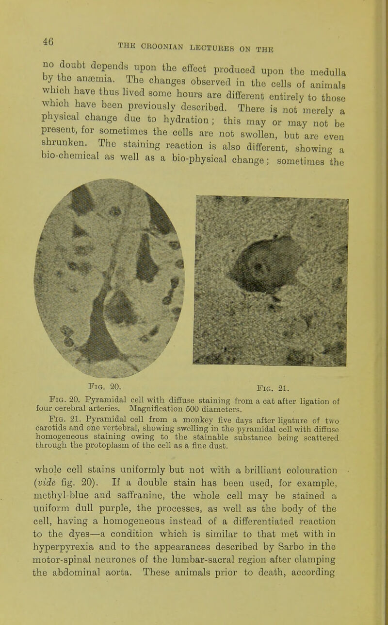 THE CHOONIAN LECTURES ON THE no doubt depends upon the effect produced upon the medulla by the m*W*, The changes observed in the cells of animals winch have thus lived some hours are different entirely to those which have been previously described. There is not merely a physical change due to hydration; this may or may not be present, for sometimes the cells are not swollen, but are even shrunken. The staining reaction is also different, showin- a bio-chemical as well as a bio-physical change; sometimes °the ■ Fig. 20. Fig. 21. Fig. 20. Pyramidal cell with diffuse staining from a cat after ligation of four cerebral arteries. Magnification 500 diameters. Fig. 21. Pyramidal cell from a monkey five days after ligature of two carotids and one vertebral, showing swelling in the pyramidal cell with diffuse homogeneous staining owing to the stainable substance being scattered through the protoplasm of the cell as a fine dust. whole cell stains uniformly but not with a brilliant colouration {vide fig. 20). If a double stain has been used, for example, methyl-blue aud saffranine, the whole cell may be stained a uniform dull purple, the processes, as well as the body of the cell, having a homogeneous instead of a differentiated reaction to the dyes—a condition which is similar to that met with in hyperpyrexia and to the appearances described by Sarbo in the motor-spinal neurones of the lumbar-sacral region after clamping the abdominal aorta. These animals prior to death, according