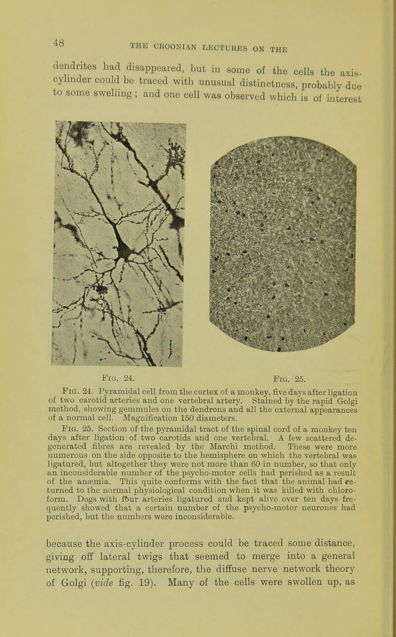 IS dendrites had disappeared, but in some of the cells the axis cylinder could be traced with unusual distinctness, probably due to some swelling ; and one cell was observed which is of interest Fig. 24. Fig. 25. Fig. 24. Pyramidal cell from the cortex of a monkey, five days after ligation of two carotid arteries and one vertebral artery. Stained by the rapid Golgi method, showing gemmules on the dendrons and all the external appearances of a normal cell. Magnification 150 diameters. Fig. 25. Section of the pyramidal tract of the spinal cord of a monkey ten days after ligation of two carotids and one vertebral. A few scattered de- generated fibres are revealed by the Marchi method. These were more numerous on the side opposite to the hemisphere on which the vertebral was ligatured, but altogether they were not more than 60 in number, so that only an inconsidei-able number of the psycho-motor cells bad perished as a result of the anaemia. This quite conforms with the fact that the animal had re- turned to the normal physiological condition when it was killed with chloro- form. Dogs with four arteries ligatured and kept alive over ten days fre- quently showed that a certain number of the psycho-motor neurones had perished, but the numbers were inconsiderable. because the axis-cylinder process could be traced some distance, giving off lateral twigs that seemed to merge into a general network, supporting, therefore, the diffuse nerve network theory of Golgi (vide fig. 19). Many of the cells were swollen up, as