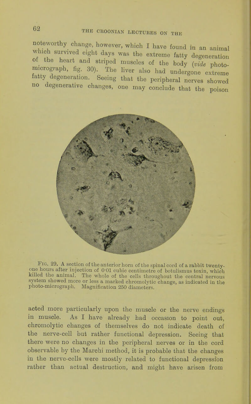 THE CUOONIAN LECTURES ON THE noteworthy change, however, which I have found in an animal winch survived eight days was the extreme fatty degeneration ot the heart and striped muscles of the body (vide photo- micrograph, fig. 30). The liver also had undergone extreme fatty degeneration. Seeing that the peripheral nerves showed no degenerative changes, one may conclude that the poison 3* - ■ Fig. 29. A section of the anterior horn of the spinal cord of a rabbit twenty- one hours after injection of O01 cubic centimetre of botulismus toxin, which killed the animal. The whole of the cells throughout the central nervous system showed more or less a marked chromolytic change, as indicated in the photo-micrograph. Magnification 250 diameters. acted more particularly upon the muscle or the nerve endings in muscle. As I have already had occasion to point out, chromolytic changes of themselves do not indicate death of the nerve-cell but rather functional depression. Seeing that there were no changes in the peripheral nerves or in the cord observable by the Marchi method, it is probable that the changes in the nerve-cells were mostly related to functional depression rather than actual destruction, and might have arisen from
