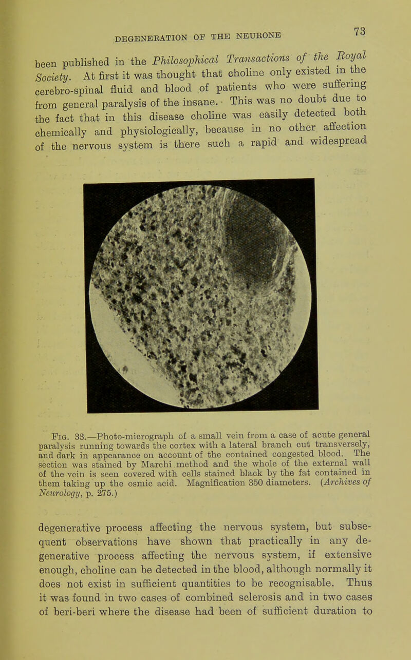 been published in the Philosophical Transactions of the Boyal Society. At first it was thought that choline only existed m the cerebrospinal fluid and blood of patients who were suffering from general paralysis of the insane. • This was no doubt due to the fact that in this disease choline was easily detected both chemically and physiologically, because in no other affection of the nervous system is there such a rapid and widespread Fig. 33.—Photo-micrograph of a small vein from a case of acute general paralysis running towards the cortex with a lateral branch cut transversely, and dark in appearance on account of the contained congested blood. The section was stained by Marchi method and the whole of the external wall of the vein is seen covered with cells stained black by the fat contained in them taking up the osmic acid. Magnification 350 diameters. (Archives of Neurology, p. 275.) degenerative process affecting the nervous system, but subse- quent observations have shown that practically in any de- generative process affecting the nervous system, if extensive enough, choline can be detected in the blood, although normally it does not exist in sufficient quantities to be recognisable. Thus it was found in two cases of combined sclerosis and in two cases of beri-beri where the disease had been of sufficient duration to