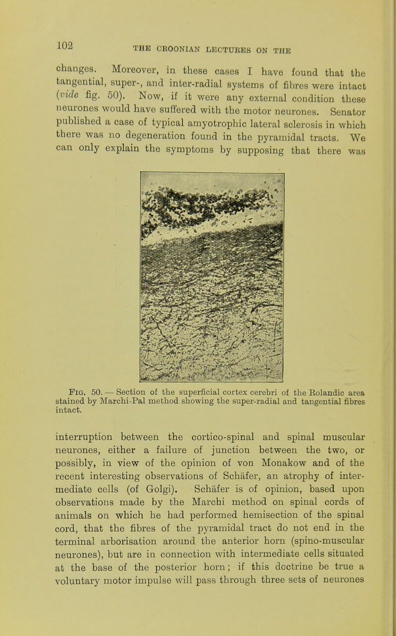 THE CROONIAN LECTURES ON THE changes. Moreover, in these cases I have found that the tangential, super-, and inter-radial systems of fibres were intact (vide fig. 50). Now, if it were any external condition these neurones would have suffered with the motor neurones. Senator published a case of typical amyotrophic lateral Bclerosis in which there was no degeneration found in the pyramidal tracts. We can only explain the symptoms by supposing that there was interruption between the cortico-spinal and spinal muscular neurones, either a failure of junction between the two, or possibly, in view of the opinion of von Monakow and of the recent interesting observations of Schafer, an atrophy of inter- mediate cells (of Golgi). Schafer is of opinion, based upon observations made by the Marchi method on spinal cords of animals on which he had performed hemisection of the spinal cord, that the fibres of the pyramidal tract do not end in the terminal arborisation around the anterior horn (spino-muscular neurones), but are in connection with intermediate cells situated at the base of the posterior horn; if this doctrine be true a voluntary motor impulse will pass through three sets of neurones