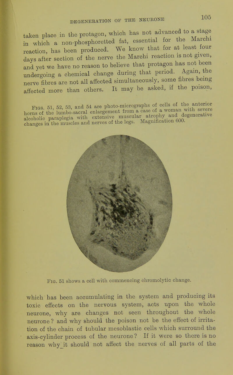 taken place in the protagon, which has not advanced to a stage in which a non-phosphoretted fat, essential for the Marchi reaction, has been produced. We know that for at least four days after section of the nerve the Marchi reaction is not given, and yet we have no reason to believe that protagon has not been undergoing a chemical change during that period. Again, the nerve fibres are not all affected simultaneously, some fibres being affected more than others. It may be asked, if the poison, Figs 51 52 53, and 54 are photo-micrographs of cells of the anterior horn of' the [umbo-sacral enlargement from a case of a woman with severe alcoholic paraplegia with extensive muscular atrophy and degenerative changes in the muscles and nerves of the legs. Magnification 600. Fig. 51 shows a cell with commencing chromolytic change. which has been accumulating in the system and producing its toxic effects on the nervous system, acts upon the whole neurone, why are changes not seen throughout the whole neurone ? and why should the poison not be the effect of irrita- tion of the chain of tubular mesoblastic cells which surround the axis-cylinder process of the neurone ? If it were so there is no reason wby_it should not affect the nerves of all parts of the