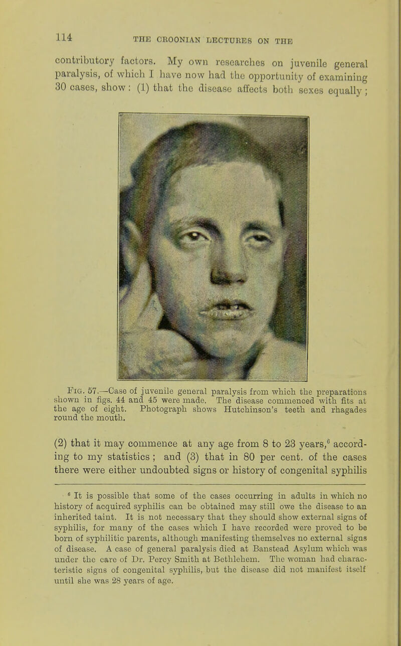contributory factors. My own researches on juvenile general paralysis, of which I have now had the opportunity of examining 30 cases, show: (1) that the disease affects both sexes equally ; Fig._ 57.—Case of juvenile general paralysis from which the preparations shown in figs. 44 and 45 were made. The disease commenced with fits at the age of eight. Photograph shows Hutchinson's teeth and rhagades round the mouth. (2) that it may commence at any age from 8 to 23 years,6 accord- ing to my statistics ; and (3) that in 80 per cent, of the cases there were either undoubted signs or history of congenital syphilis 6 It is possible that some of the cases occurring in adults in which no history of acquired syphilis can be obtained may still owe the disease to an inherited taint. It is not necessary that they should show external signs of syphilis, for many of the cases which I have recorded were proved to be born of syphilitic parents, although manifesting themselves no external signs of disease. A case of general paralysis died at Banstead Asylum which was under the care of Dr. Percy Smith at Bethlehem. The woman had charac- teristic signs of congenital syphilis, but the disease did not manifest itself until she was 28 years of age.