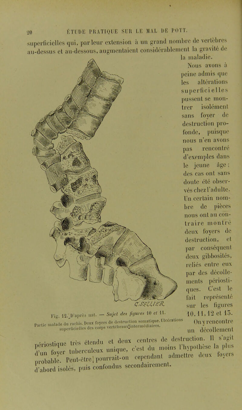 superficielles qui, parleur extension à un grand nombre de vertèbre au-dessus el au-dessous, augmentaient considérablement la gravité de la maladie. Nous avons à peine admis que les altérations superfici elles pussent se mon- trer isolément sans foyer de destruction pro- fonde, puisque nous n'en avons pas rencontré d'exemples dans le jeune âge ; des cas ont sans doute été obser- vés chez l'adulte. Un certain nom- bre de pièces nous ont au con- traire montré deux foyers de destruction, et par conséquent deux gibbosilés, reliés entre eux par des décolle- ments périosli- ques. C'est le fait représenté sur les ligures 10,11,12 et 15. h^rtp malade du'raohis. Deux foyers de destruction somatique. Ulcérations Qn rencont,.c Partie malade du ,cidies corps vei,,bl,uxIinlennediairc, ^ (/ecolIcmcnl • • ,• « tvb* étendu et deux centres de destruction. Il s'agit ïMï r 1 - unique, Ces, du moins l'hypothèse U plu. Sablfpeut-étrejpourrait-on cependant admettre deux foyers d'abord isolés, puis confondus secondairement. Fig. 12/Faprès tiat. - Sujet des figures 10 cl il.
