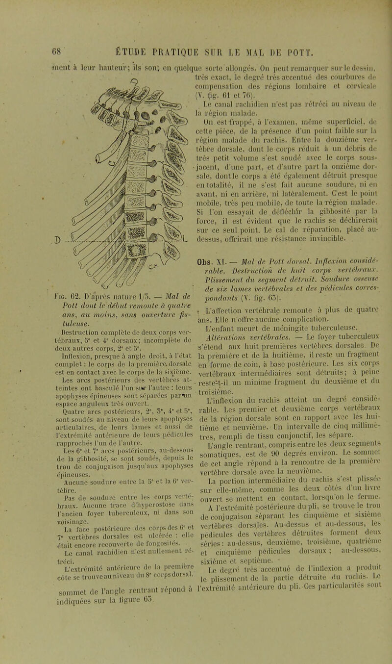 mont à leur hauteur; ils sont en quelque sorte allongés. On peut remarquer sur le dessin. très exact, le degré très accentué des courbures de compensation des régions lombaire et cervicale; (V. \]g. 61 et 76). Le canal racliidien n'est pas rétréci au niveau de la région malade. Un est frappé, à l'examen, même superficiel, de cette pièce, de la présence d'un point faible sur la région malade du racliis. Entre la douzième ver- tèbre dorsale, dont le corps réduit à un débris de très petit volume s'est soudé avec le corps sous- •jacent, d'une part, et d'autre part la onzième dor- sale, dont le corps a élé également détruit presque en totalité, il ne s'esl fail aucune soudure, ni en avant, ni en arrière, ni latéralement. C'est le point mobile, très peu mobile, de toute la région maladi Si l'on essayait de.défléchir la gibbosité par la force, il est évident que le rachis se déebirerait sur ce seul point. Le cal de réparation, placé au- dessus, offrirait une résistance invincible. D I'ig. 62. D'après nature 1/5. — Mal de Poil dont le début remonte à quatre ans, au moins, sans ouverture fis- tuleuse. Destruction complète île deux corps ver- tébraux, 5 et 4 dorsaux; incomplète de deux autres corps, 2° et 5*. Inflexion, presque à angle droit, à l'état complet : le corps de la première,dorsale est en contact avec le corps de la sixième. Les arcs postérieurs des vertèbres at- teintes ont basculé l'un sur l'autre : leurs apophyses épineuses sont séparées par*un espace anguleux très ouvert. Quatre arcs postérieurs, v2. 5, -t et 3°. sont soudés au niveau de leurs apophyses articulaires, de leurs lames et aussi de l'extrémité antérieure de leurs pédicules rapprochés l'un de l'autre; Les 6° et 7 arcs postérieurs, au-dessoiis de la gibbosité, se sont soudés, depuis le trou de conjugaison jusqu'aux apophyses épineuses. Aucune soudure entre la 5* et la 6' ver- tèbre. Pas de soudure entre les corps verté- braux. Aucune tiare d'hyperostose dans l'ancien foyer tuberculeux, ni dans -on voisinage. face postérieure de- corps des 6' et vertèbres dorsales est ulcérée : elle était encore recouverte de fongosilés. i,. cana] racliidien n'est nullement ré- tréci. L'extrémité antérieure de la première cote se trouve au niveau du 8 corpsdorsal. sommet de l'angle rentranl répond a indiquées sur la figure 63 Obs. XL — Mal de Poil dorsal. Inflexion considé- rable. Destruction de huit corps vertébraux. Plissement du segment détruit. Soudure osseuse de six lames vertébrales et des pédicules corres- pondants (V. fig. 65). • L'affection vertébrale remonte à plus de quatre ans. Elle n'offreauctînè complication. L'enfant meurt de méningite tuberculeuse. Altérations vertébrales. — Le loyer tuberculeux s'étend aux huit premières vertèbres dorsales De la première et de la huitième, ilreste un fragment en forme de coin, à base postérieure. Les six corps vertébraux intermédiaires sont détruits; à peine reste-t-il un minime fragment du deuxième et du troisième. L'inflexion du racliis atteint un degré considé- rable. Les premier et deuxième corps vertébraux de la région dorsale sont en rapport avec les hui- tième et neuvième. En intervalle de cinq millimè- tres, rempli de tissu conjonefif. les sépare. L'angle rentrant , compris entre les deux segments somatiques, est de 90 degrés environ. Le sommet de cet angle répond à la rencontre de la première vertèbre dorsale avec la neuvième. La portion intermédiaire du racliis s'esl plissée sur elle-même, comme les deux côtés d'un livre ouvert se mettent en contact, lorsqu'on le ferme- A l'extrémité postérieure du pli, se trouve le trou de conjugaison séparant les cinquième el sixième vertèbres dorsales. Au-dessus el au-dessous, les pédicules des vertèbres détruites forment deux séries: au-dessus, deuxième, troisième, quatrième et cinquième pédicules dorsaux ; au-dessous, sixième el septième. Le degré Irès accentué de l'inflexion a produit le plissement de la partie détruite du racliis. Le l'extrémité antérieure du pli. Ces particularités sont