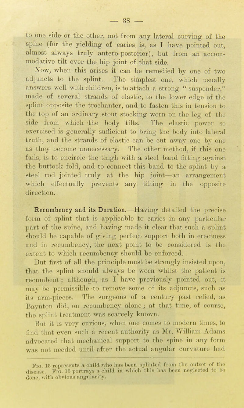 to one side or the other, not from any lateral curving of the spine (for the yielding of caries is, as I have pointed out, almost always truly antero-posterior), but from an accom- modative tilt over the hip joint of that side. Now, when this arises it can be remedied by one of two adjuncts to the splint. The simplest one, which usually answers well with children, is to attach a strong  suspender, made of several strands of elastic, to the lower edge of the splint opposite the trochanter, and to fasten this in tension to the top of an ordinary stout stocking worn on the leg of the side from which the body tilts. The elastic power so exercised is generally sufficient to bring the body into lateral truth, and the strands of elastic can be cut away one by one as they become unnecessary. The other method, if this one fails, is to encircle the thigh with a steel band fitting against the buttock fold, and to connect this band to the splint by a steel rod jointed truly at the hip joint—an arrangement which effectually prevents any tilting in the opposite direction. Recumbency and its Duration.—Having detailed the precise form of splint that is applicable to caries in any particular part of the spine, and having made it clear that such a splint should be capable of giving perfect support both in ereetness and in recumbency, the next point to be considered is the extent to which recumbency should be enforced. But first of all the principle must be strongly insisted upon, that the splint should always be worn whilst the patient is recumbent; although, as I have previously pointed out, it may be permissible to remove some of its adjuncts, such as its arm-pieces. The surgeons of a century past relied, as Baynton did, on recumbency alone; at that time, of course, the splint t reatment was scarcely known. But it is very curious, when one comes to modern times, to find that even such a recent authority as Mr. William Adams advocated that mechanical support to the spine in any form was not needed until after the actual angular curvature had Pig, 16 represents a child who has been splinted from Hi outset of the disease. Pig. 16 portrays a ohild in which this has been neglected (■» be done, with obvious angularity.