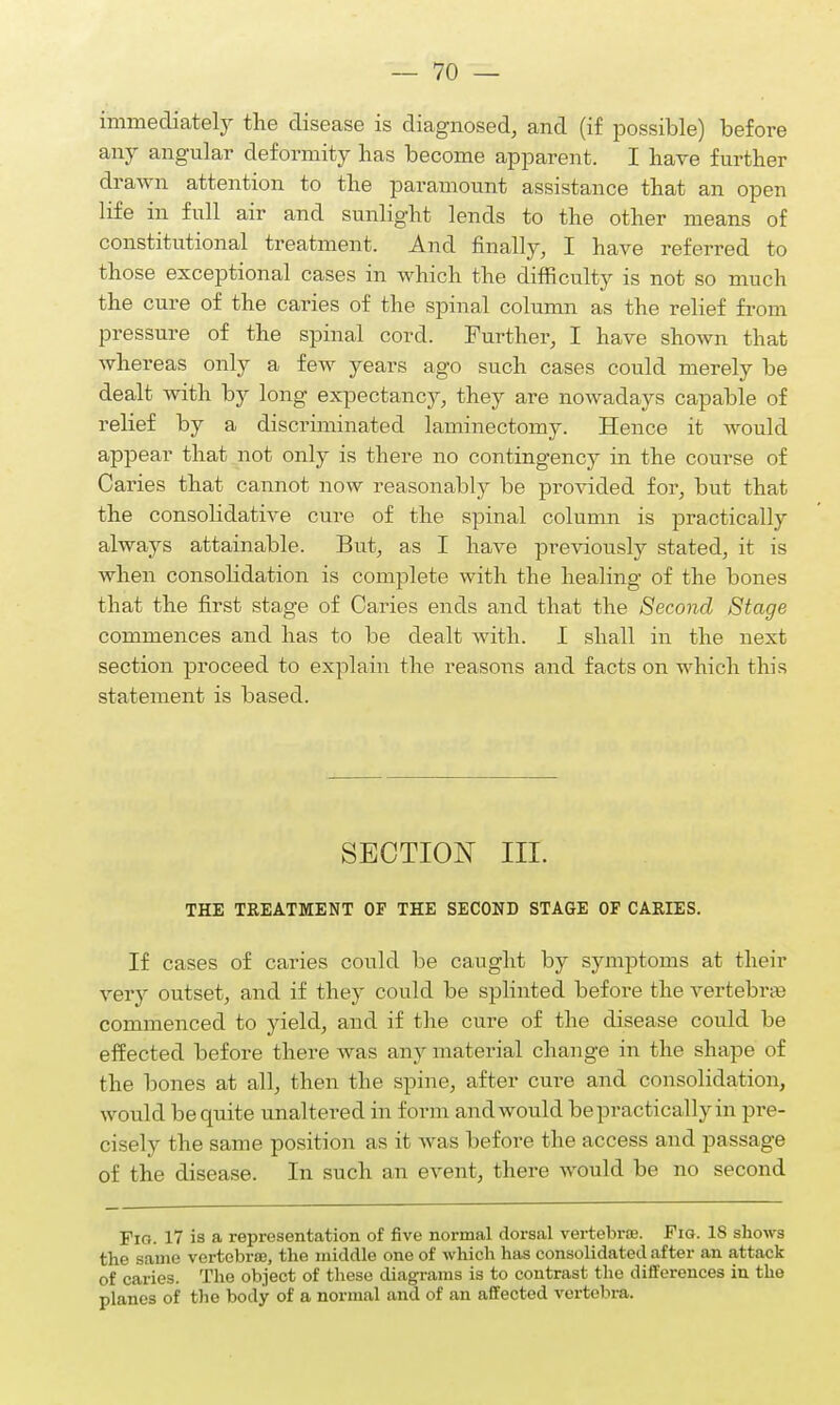 immediately the disease is diagnosed, and (if possible) before any angular deformity has become apparent. I have further drawn attention to the paramount assistance that an open life in full air and sunlight lends to the other means of constitutional treatment. And finally, I have referred to those exceptional cases in which the difficulty is not so much the cure of the caries of the spinal column as the relief from pressure of the spinal corcl. Further, I have shown that whereas only a few years ago such cases could merely be dealt with by long expectancy, they are nowadays capable of relief by a discriminated laminectomy. Hence it would appear that not only is there no contingency in the course of Caries that cannot now reasonably be provided for, but that the consolidative cure of the spinal column is practically always attainable. But, as I have previously stated, it is when consoHdation is complete with the healing of the bones that the first stage of Caries ends and that the Second Stage commences and has to be dealt with. I shall in the next section proceed to explain the reasons and facts on which this statement is based. SECTION III. THE TREATMENT OF THE SECOND STAGE OF CARIES. If cases of caries could be caught by symptoms at their very outset, and if they could be splinted before the vertebra? commenced to yield, and if the cure of the disease could be effected before there was any material change in the shape of the bones at all, then the spine, after cure and consolidation, would be quite unaltered in form and would be practically in pre- cisely the same position as it was befoi-e the access and passage of the disease. In such an event, there would be no second Fig. 17 is a representation of five normal dorsal vertebras. Fig. 18 shows the same vertebras, the middle one of which has consolidat ed after an attack of caries. The object of these diagrams is to contrast the differences in the planes of the body of a normal and of an affected vertebra.
