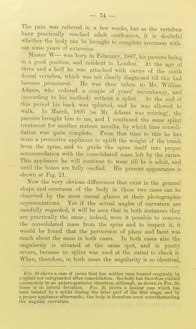 The pain was relieved in a few weeks, but as the vertebra- have practically reached adult ossification, it is doubtful whether the body can be brought to complete erectness with- out some years of extension. Master W— was born in February, 1887, his parents being in a good position, and resident in London. At the age of three and a half he was attacked with caries of the ninth dorsal vertebra, which was not clearly diagnosed till this had become prominent. He was then taken to Mr. William Adams, who ordered a couple of years' recumbency, and (according to his method) without a splint. At the end of this period his back was splinted, and he was allowed to walk. In March, 1895 (as Mr. Adams was retiring), the parents brought him to me, and I continued the same splint treatment for another sixteen months, by which time consoli- dation was quite complete. From that time to this he has worn a protective appliance to uplift the weight of the trunk from the spine, and to guide the spine itself into proper accommodation with the consolidated mass left by the caries. This appliance he will continue to wear till he is adult, and until the bones are fully ossified. His present appearance is shown at Fig. 21. Now the very obvious differences that exist in the general shape and erectness of the body in these two cases can be observed by the most casual glance at their photographic representations. Yet - if the actual angles of curvature are carefully regarded, it will be seen that in both instances they are practically the same; indeed, were it possible to remove the consolidated mass from the spine and to inspect it, it would be found that the perversion of plane and facet was much about the same in both cases. In both cases also the angularity is situated at the same spot, and is pretty severe, because no splint was used at the outset to check it. When, therefore, in both cases the angularity is so identical, Fig. 19 shows a case of caries that has neither been treated originally by a splint nor safeguarded after consolidation; the body has therefore yielded enormously in an antero-posterior direction, although, as shown in Fig. 20, there is no lateral deviation. Fig. 21 shows a similar case which has been treated by a splint during the later part of the first stage, and by a proper appliance afterwards ; the body is therefore erect notwithstanding the angular curvature.