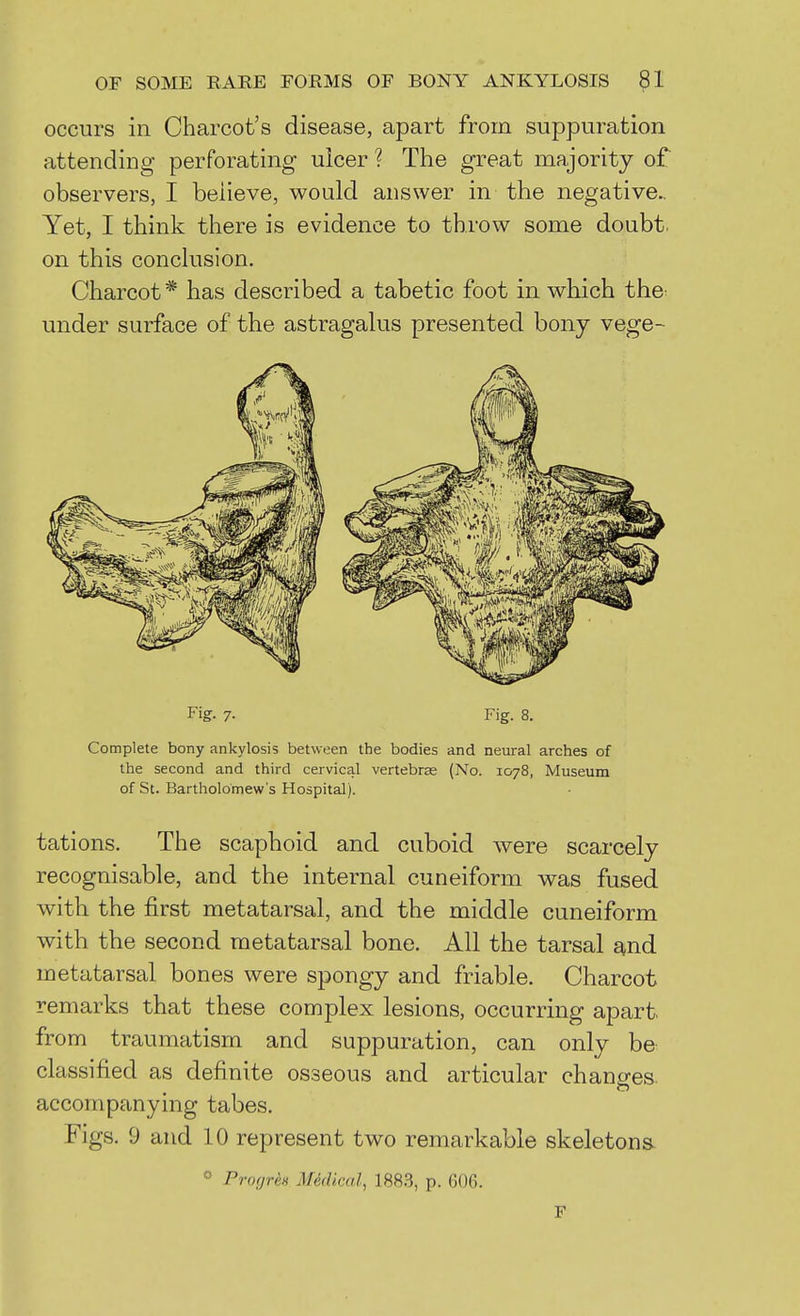 occurs in Charcot's disease, apart from suppuration attending perforating ulcer ? The great majority of observers, I believe, would answer in the negative- Yet, I think there is evidence to throw some doubt, on this conclusion. Charcot* has described a tabetic foot in which the^ under surface of the astragalus presented bony vege- Fig. 7. Fig. 8. Complete bony ankylosis between the bodies and neural arches of the second and third cervical vertebras (No. 1078, Museum of St. Bartholomew's Hospital). tations. The scaphoid and cuboid were scarcely recognisable, and the internal cuneiform was fused with the first metatarsal, and the middle cuneiform with the second metatarsal bone. All the tarsal and metatarsal bones were spongy and friable. Charcot remarks that these complex lesions, occurring apart, from traumatism and suppuration, can only be classified as definite osseous and articular chantres accompanying tabes. Figs. 9 and 10 represent two remarkable skeletons. Profjres Medical, 1883, p. G06. F