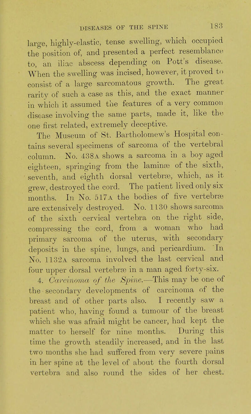 large, highly-elastic, tense swelling, Avhich occupied the position of, and presented a perfect resemblance to, an iliac abscess depending on Pott's disease. When the swelling was incised, however, it proved to consist of a large sarcomatous growth. The great rarity of such a case as this, and the exact manner in which it assumed the features of a very common disease involving the same parts, made it, like the one first related, extremely deceptive. The Museum of St. Bartholomew's Hospital con- tains several specimens of sarcoma of the vertebral column. No. 438a shows a sarcoma in a boy aged eighteen, springing from the laminse of the sixth, seventh, and eighth dorsal vertebra?,, which, as it grew, destroyed the cord. The patient lived only six months. In No. 517a the bodies of five vertebrae are extensively destroyed. No. 1130 shows sarcoma of the sixth cervical vertebra on the right side, compressing the cord, from a woman who had primary sarcoma of the uterus, with secondary deposits in the spine, lungs, and pericardium. In No. 1132a sarcoma involved the last cervical and four upper dorsal vertebrae in a man aged forty-six. 4. Carcinoma of the Spine.—This may be one of the secondary developments of carcinoma of the breast and of other parts also. I recently saw a patient who, having found a tumour of the breast which she was afraid might be cancer, had kept the matter to herself for nine months. During this time the growth steadily increased, and in the last two months she had suffered from very severe pains in her spine at the level of about the fourth dorsal vertebra and also round the sides of her chest.