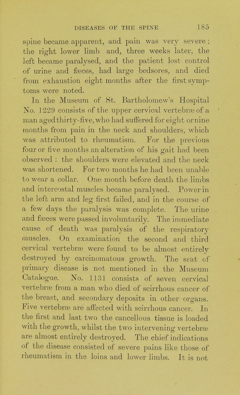 Spine became apparent, and pain was very severe ; the right lower limb and, three weeks later, the left became paralysed, and the patient lost control of urine and fseces, had large bedsores, and died from exhaustion eight months after the first symjD- toms were noted. In the Museum of St. Bartholomew's Hospital No. 1229 consists of the upper cervical vertebrae of a ' man aged thirty-five, who had sufiered for eight or nine months from pain in the neck and shoulders, which was attributed to rheumatism. For the previous four or five months an alteration of his gait had been observed : the shoulders were elevated and the neck was shortened. For two months he had been unable to wear a collar. One month before death the limbs and intercostal muscles became paralysed. Power in the left arm and leg first failed, and in the course of a few days the paralysis was complete. The urine . and faeces were passed involuntarily. The immediate cause of death was paralysis of the respiratory muscles. On examination the second and third cervical vertebrae were found to be almost entirely destroyed by carcinomatous growth. The seat of • jmmary disease is not mentioned in the Museum Catalogue. No. 1131 consists of seven cervical vertebrae from a man who died of scirrhous cancer of the breast, and secondary deposits in other organs. Five vertebrae are affected with scirrhous cancer. In the first and last two the cancellous tissue is loaded with the growth, whilst the two intervening vertebrfB are almost entirely destroyed. The chief indications of the disease consisted of severe pains like those of rheumatism in the loins and lower limbs. It is not