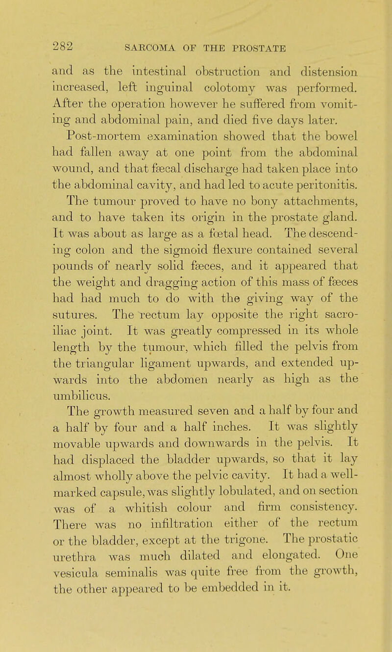 and as the intestinal obstruction and distension increased, left inguinal colotomy was performed. After the operation however he suffered from vomit- ing and abdominal pain, and died five days later. Post-mortem examination showed that the bowel had fallen away at one point from the abdominal wound, and that fsecal discharge had taken place into the abdominal cavity, and had led to acute peritonitis. The tumour proved to have no bony attachments, and to have taken its oiigin in the prostate gland. It was about as large as a foetal head. The descend- ing colon and the sigmoid flexure contained several pounds of nearly solid faeces, and it appeared that the weight and dragging action of this mass of faeces had had much to do with the giving way of the sutures. The rectum lay opj^osite the right sacro- iliac joint. It was greatly compressed in its whole length by the tumour, which filled the pelvis from the triangular ligament upwards, and extended up- wards into the abdomen nearly as high as the umbilicus. The growth measured seven and a half by four and a half by four and a half inches. It was slightly movable upwards and downwards in the pelvis. It had disj^laced the bladder upwards, so that it lay almost wholly above the pelvic cavity. It had a well- marked capsule, was slightly lobulated, and on section was of a whitish colour and firm consistency. There was no infiltration either of the rectum or the bladder, except at the trigone. The prostatic urethra was much dilated and elongated. One vesicula seminalis was quite free from the growth, the other appeared to be embedded in it.