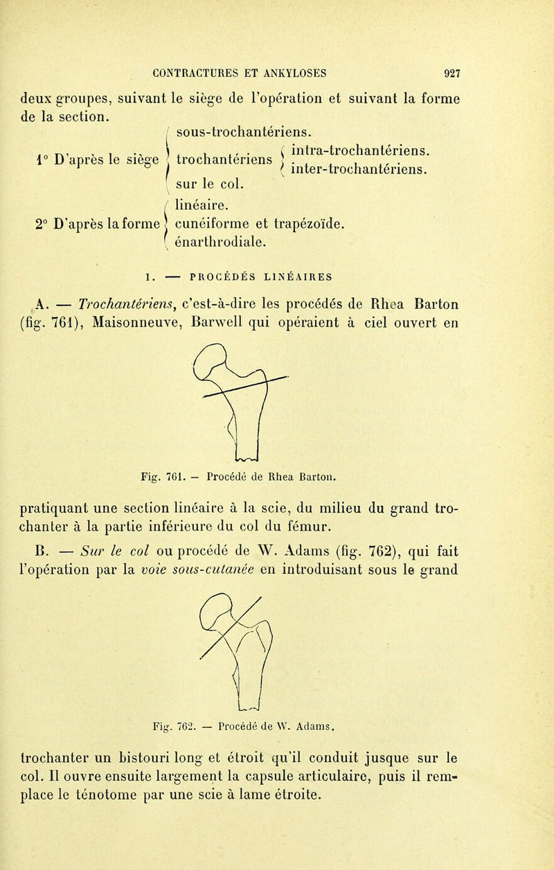 deux groupes, suivant le siège de l'opération et suivant la forme de la section. / sous-trochantériens. ,„ t., , , \ . , ., . ( intra-trochantériens. 1° D après le siège trochantenens ] . . , , ,, . ( mter-trochantenens. [ sur le col. / linéaire. 2° D'après la forme ] cunéiforme et trapézoïde. ( énarthrodiale. I. PROCÉDÉS LINÉAIRES A. — Trochantériens, c'est-à-dire les procédés de Rhoa Barton (fig. 761), Maisonneuve, Barwell qui opéraient à ciel ouvert en Procédé de Rhea Barton. pratiquant une section linéaire à la scie, du milieu du grand tro- chanter à la partie inférieure du col du fémur. B. — Sur le col ou procédé de W. Adams (fig. 762), qui fait l'opération par la voie sous-cutanée en introduisant sous le grand Fig. 762. — Procédé de W. Adams. trochanter un bistouri long et étroit qu'il conduit jusque sur le col. Il ouvre ensuite largement la capsule articulaire, puis il rem- place le ténotome par une scie à lame étroite.