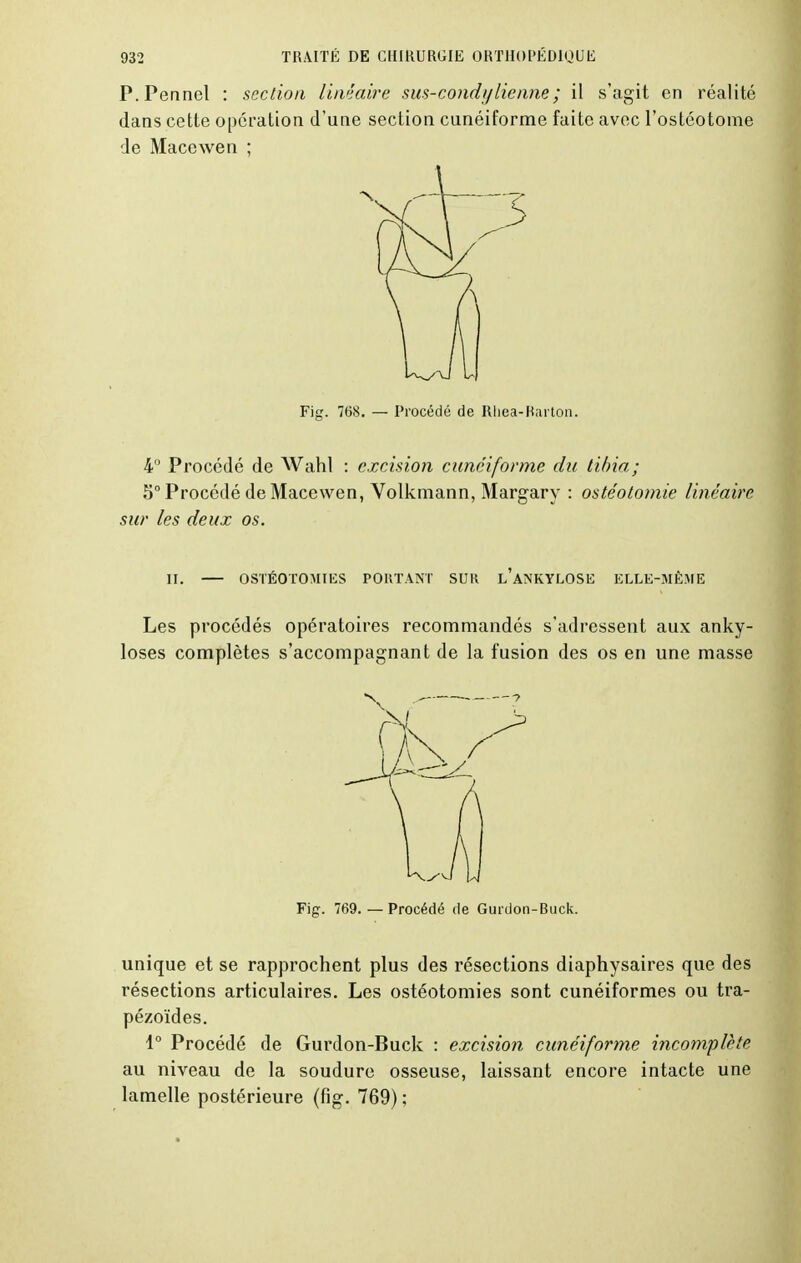 P.Pennel : section linéaire sus-condylienne ; il s'agit en réalité dans cette opération d'une section cunéiforme faite avec l'ostéotome de Macewen ; Fig. 768. — Procédé de Rhea-Rarton. 4° Procédé de Wahl : excision cunéiforme du tibia; 5° Procédé de Macewen, Volkmann, Margary : ostéotomie linéaire sur les deux os. II. OSTÉOTOMIES PORTANT SUR l'aN'KYLOSE ELLE-MÊME Les procédés opératoires recommandés s'adressent aux anky- loses complètes s'accompagnant de la fusion des os en une masse Fig. 769.—Procédé de Gurdon-Buck. unique et se rapprochent plus des résections diaphysaires que des résections articulaires. Les ostéotomies sont cunéiformes ou tra- pézoïdes. 1° Procédé de Gurdon-Buck : excision cunéiforme incomplète au niveau de la soudure osseuse, laissant encore intacte une lamelle postérieure (fig. 769);