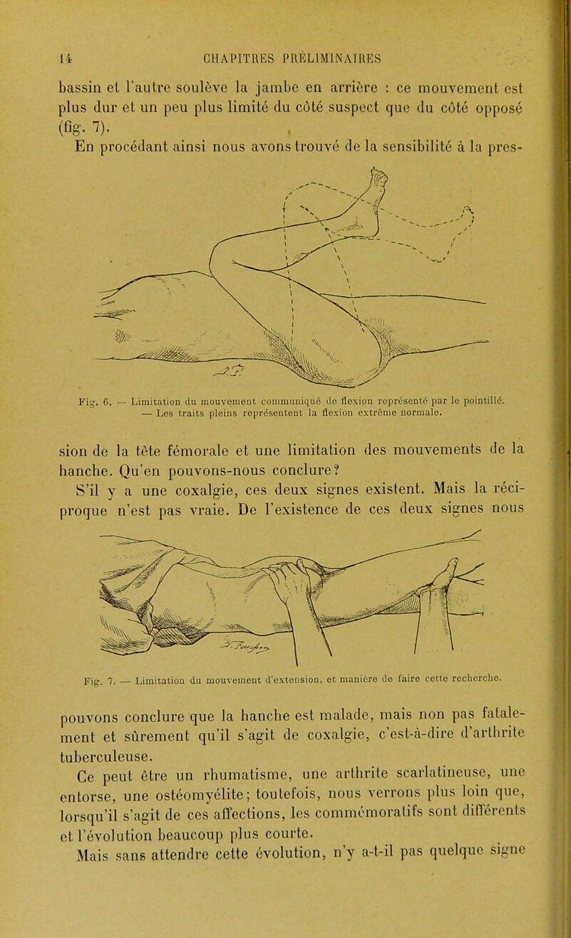 bassin et l'autre soulève la jambe en arrière : ce mouvement est plus dur et un peu plus limité du côté suspect que du côté opposé En procédant ainsi nous avons trouvé de la sensibilité à la pres- Fig. 6. — Limitation du mouvement communiqué do flexion représenté par le pointillé. — Les traits pleins représentent la flexion extrême normale. sion de la tète fémorale et une limitation des mouvements de la hanche. Qu'en pouvons-nous conclure? S'il y a une coxalgie, ces deux signes existent. Mais la réci- proque n'est pas vraie. De l'existence de ces deux signes nous Fig. 7. — Limitation du mouvement d'extension, et manière do faire eelto recherche. pouvons conclure que la hanche est malade, mais non pas fatale- ment et sûrement qu'il s'agit de coxalgie, c'est-à-dire d'arthrite tuberculeuse. Ce peut être un rhumatisme, une arthrite scarlatineuse, une entorse, une ostéomyélite; toutefois, nous verrons plus loin que, lorsqu'il s'agit de ces affections, les commémoratifs sont différents et l'évolution beaucoup plus courte. Mais sans attendre cette évolution, n'y a-t-il pas quelque signe