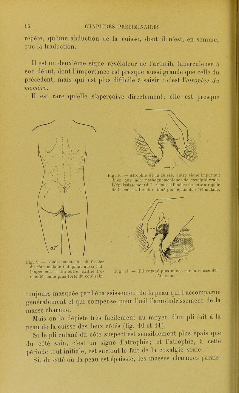 répète, qu'une abduction de la cuisse, dont il n'est, en somme, que la traduction. Il est un deuxième signe révélateur de l'arthrite tuberculeuse à son début, dont l'importance est presque aussi grande que celle du précédent, mais qui est plus difficile à saisir : c'est Y atrophie du membre. Il est rare qu'elle s'aperçoive directement; elle est presque Fig. 9. — Abaissement du pli fessier du côté malade indiquant aussi l'al- longement. — En outre, saillie tro- Fig. 11. — Pli cutané plus mince sur la cuisse du chantérienne plus forte du côté sain. côté sain. toujours masquée par l'épaississement de la peau qui l'accompagne généralement et qui compense pour l'œil l'amoindrissement de la masse charnue. Mais on la dépiste très facilement au moyen d'un pli fait à la peau de la cuisse des deux côtés (fig. 10 et 11). Si le pli cutané du côté suspect est sensiblement plus épais que du côté sain, c'est un signe d'atrophie; et l'atrophie, à celle période tout initiale, est surtout le fait de la coxalgie vraie. Si, du côté où la peau est épaissie, les masses charnues parais-