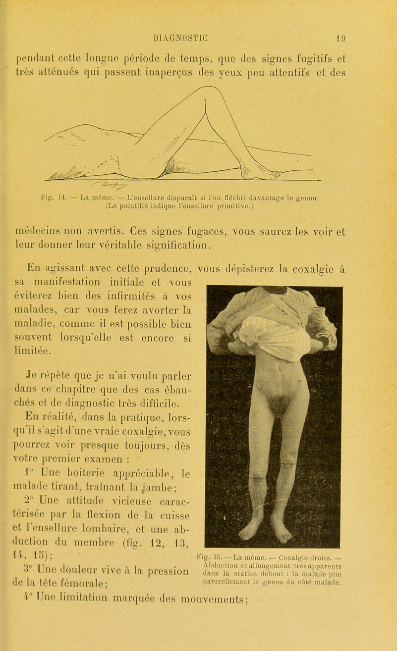 pendant cette longue période de temps, que des signes fugitifs et très atténués qui passent inaperçus des yeux peu attentifs et des Fig. 14. — La mémo. — L'onsellure disparaît si l'on lléchit davantage le genou. (Le pointillé indique l'ensellure primitive.) médecins non avertis. Ces signes fugaces, vous saurez les voir et leur donner leur véritable signification. En agissant avec cette prudence, vous dépisterez la coxalgie à sa manifestation initiale et vous éviterez bien des infirmités à vos malades, car vous ferez avorter la maladie, comme il est possible bien souvent lorsqu'elle est encore si limitée. Je répète que je n'ai voulu parler dans ce chapitre que des cas ébau- chés et de diagnostic très difficile. En réalité, dans la pratique, lors- qu'il s'agit d'une vraie coxalgie, vous pourrez voir presque toujours, dès votre premier examen : 1 Une boiterie appréciable, le malade tirant, traînant la jambe; 2° Une attitude vicieuse carac- térisée par la flexion de la cuisse et l'ensellure lombaire, et une ab- duction du membre (fig. 12, 13, 14, 18); 3° Une douleur vive à la pression •le la tête fémorale; V Une limitation marquée des mouvements; Fig. 15.— La mémo. — Coxalgie droite. — Abduction el àllongoment trôsapparents dans la station doboul : la malade plie naturellement le genou du côté malade.