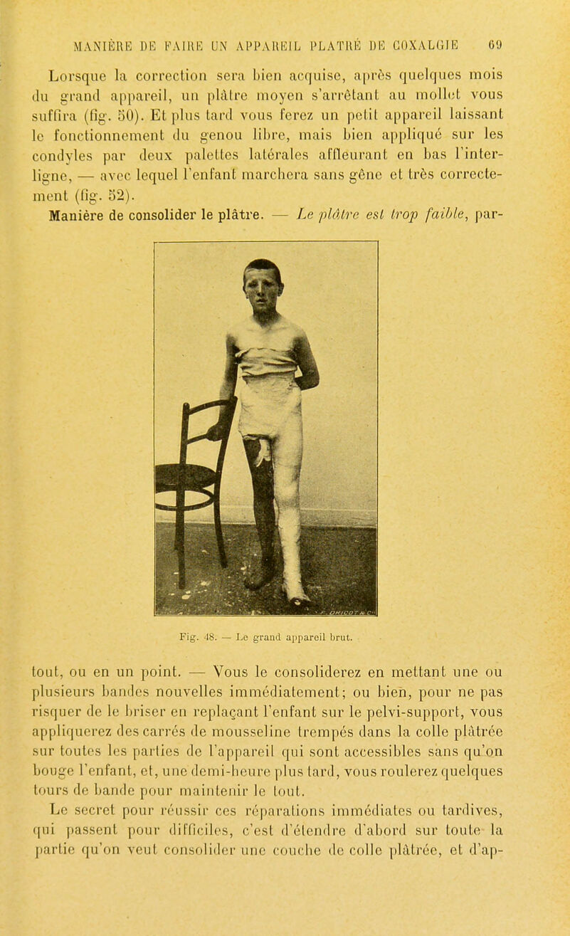 Lorsque la correction sera bien acquise, après quelques mois du grand appareil, un plâtre moyen s'arrêtant au mollet vous suffira (fig. 50). Et plus tard vous ferez un petit appareil laissant le fonctionnement du genou libre, mais bien appliqué sur les condyles par deux palettes latérales affleurant en bas l'inter- ligne, — avec lequel l'enfant marchera sans gêne et très correcte- ment (fig. 52). Manière de consolider le plâtre. - - Le plaire esl Irop faible, par- Fig. 48. — Lo grand appareil brut. tout, ou en un point. — Vous le consoliderez en mettant une ou plusieurs bandes nouvelles immédiatement; ou bien, pour ne pas risquer de le briser en replaçant l'enfant sur le pelvi-support, vous appliquerez des carrés de mousseline trempés dans la colle plâtrée sur toutes les parties de l'appareil qui sont accessibles sans qu'on bouge l'enfant, et, une demi-heure plus lard, vous roulerez quelques tours de bande pour maintenir le tout. Le secret pour réussir ces réparations immédiates ou tardives, qui passent pour difficiles, c'est d'élendre d'abord sur toute la partie qu'on veut consolider une couche de colle plâtrée, et d'ap-