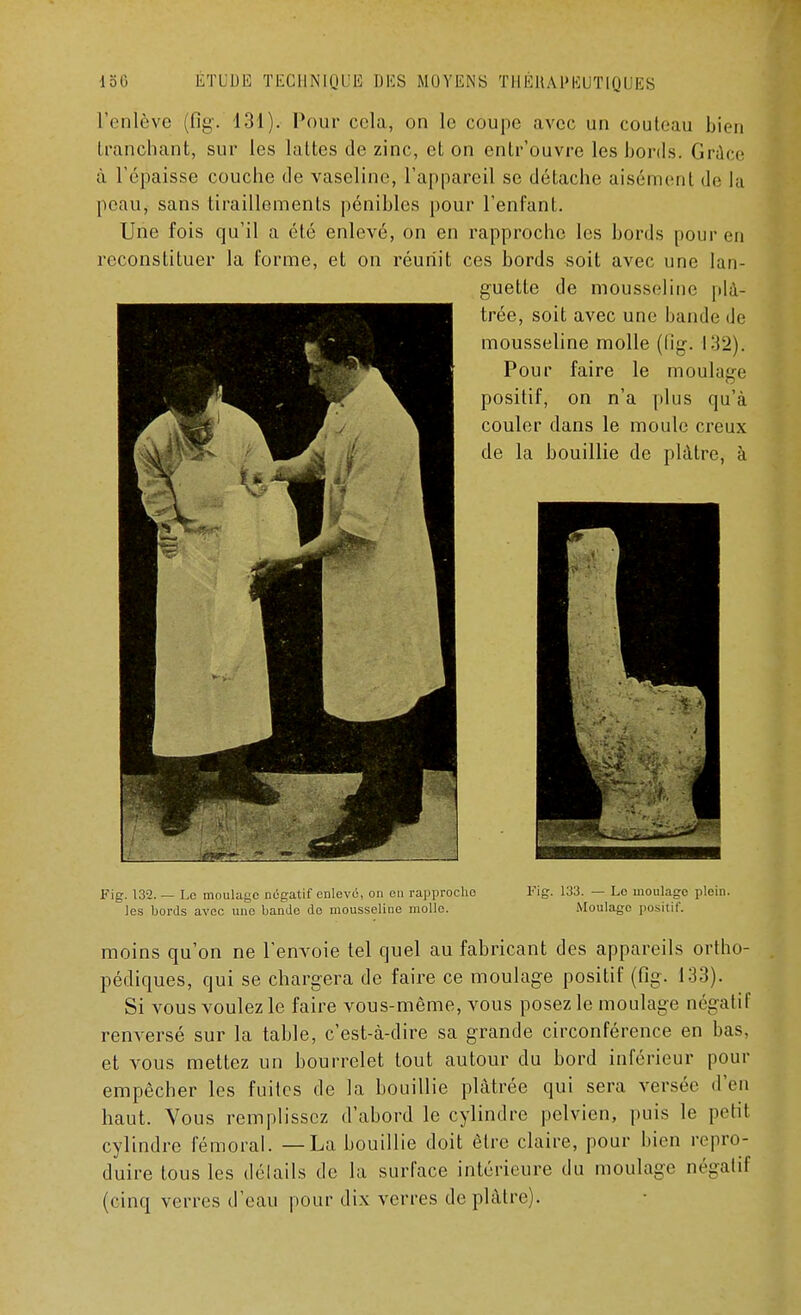 L'enlève (fig. 131). Pour cela, on le coupe avec un couteau bien tranchant, sur les lattes de zinc, et on entr'ouvre les bords. Grâce à l'épaisse couche de vaseline, l'appareil se détache aisément de la peau, sans tiraillements pénibles pour l'enfant. Une fois qu'il a été enlevé, on en rapproche les bords pour en reconstituer la forme, et on réunit ces bords soit avec une lan- guette de mousseline plâ- trée, soit avec une bande <Je mousseline molle (fig. 132). Pour faire le moulage positif, on n'a plus qu'à couler dans le moule creux de la bouillie de plâtre, à Fig. 132. — Lo moulage négatif enlevé, on en rapproche les bords avec une bande de mousseline molle. Fig. 133. — Lo moulage plein. Moulage positif. moins qu'on ne l'envoie tel quel au fabricant des appareils ortho- pédiques, qui se chargera de faire ce moulage positif (fig. 133). Si vous voulez le faire vous-même, vous posez le moulage négatif renversé sur la table, c'est-à-dire sa grande circonférence en bas, et vous mettez un bourrelet tout autour du bord inférieur pour empêcher les fuites de la bouillie plâtrée qui sera versée d'en haut. Vous remplissez d'abord le cylindre pelvien, puis le petit cylindre fémoral. — La bouillie doit être claire, pour bien repro- duire tous les détails de la surface intérieure du moulage négatif (cinq verres d'eau pour dix verres déplâtre).