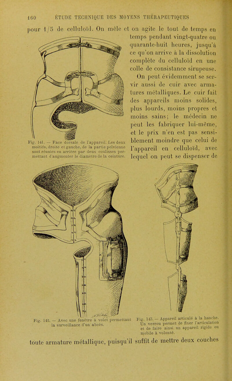 pour 1/5 de celluloïd. On mêle et on agite le toul de temps en temps pendant vingt-quatre ou quarante-huit heures, jusqu'à ce qu'on arrive à la dissolution complète du celluloïd en une colle de consistance sirupeuse. On peut évidemment se ser- vir aussi de cuir avec arma- tures métalliques. Le cuir fait des appareils moins solides, plus lourds, moins propres et moins sains; le médecin ne peut les fabriquer lui-même, et le prix n'en est pas sensi- Fig. 141. — Face doïsaie de l'appareil. Les deux blement moindre que celui de moitiés, droite et gaucho, de la partie pelvienne l'armareil en Celluloïd avec sont réunies en arrière par deux coulisses per- Il ' mettant d'augmenter le diamètre de la ceinture, lequel On peut Se dispenser de Fig. 142. — Avec une fonûtro à volet permettant la surveillance d'un abcès. Fig. 143. — Appareil articulé à la hanche. Un verrou permet de fixer l'articulation et de l'aire ainsi un appareil rigide ou mobile à volonté. toute armature métallique, puisqu'il suffit de mettre deux couches