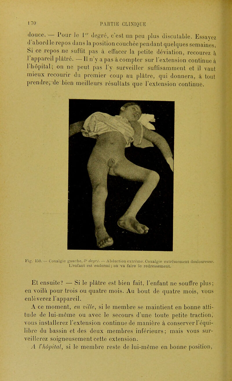 douce. — Pour le I  degré, c'est un peu [dus discutable. Essayez d'abord le repos dans la position couchée pendant quelques semaines. Si ce repos ne suffit pas à effacer la petite déviation, recourez ,:i l'appareil plâtré. —11 n'y a pas à compter sur l'extension continue à l'hôpital; on no peut pas l'y surveiller suffisamment et il vaut mieux recourir du premier coup au plâtre, qui donnera, à tout prendre, de bien meilleurs résultats que l'extension continue. Fig. 150. — Coxalgie g-auche, ù'L' deyrê. — Abduction extrême. Coxalgie extrêmement douloureuse. L'enfant est endormi; on va faire le redressement. Et ensuite? — Si le plâtre est bien fait, l'enfant ne souffre plus; en voilà pour trois ou quatre mois. Au bout de quatre mois, vous enlèverez l'appareil. A ce moment, en ville, si le membre se maintient en bonne atti- tude de lui-même ou avec le secours d'une toute petite traction, vous installerez l'extension continue de manière à conserver l'équi- libre du bassin et des deux membres inférieurs; mais vous sur- veillerez soigneusement cette extension. A Vhôpital, si le membre reste de lui-même en bonne position,