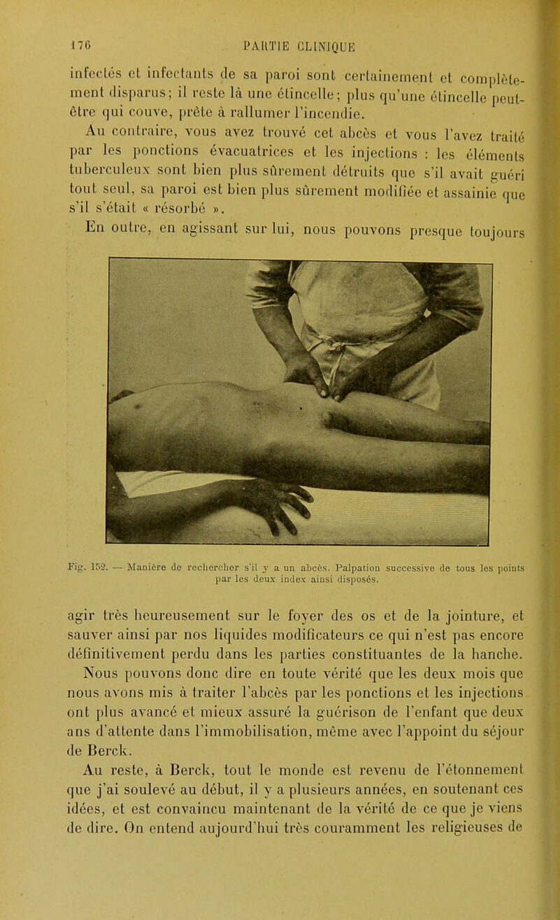 infectés et infectants de sa paroi sont certainement et complète- ment disparus; il reste là une étincelle; plus qu'une étincelle peut- être qui couve, prête à rallumer l'incendie. Au contraire, vous avez trouvé cet abcès et vous l'avez traité par les ponctions évacuatrices et les injections : les éléments tuberculeux sont bien plus sûrement détruits que s'il avait guéri tout seul, sa paroi est bien plus sûrement modifiée et assainie que s'il s'était « résorbé ». En outre, en agissant sur lui, nous pouvons presque toujours Fig. 152. — Manière de rechercher s'il y a un abcès. Palpation successive de tous les points par les deux index ainsi disposés. agir très heureusement sur le foyer des os et de la jointure, et sauver ainsi par nos liquides modificateurs ce qui n'est pas encore définitivement perdu dans les parties constituantes de la hanche. Nous pouvons donc dire en toute vérité que les deux mois que nous avons mis à traiter l'abcès par les ponctions et les injections ont plus avancé et mieux assuré la guérison de l'enfant que deux ans d'attente dans l'immobilisation, même avec l'appoint du séjour de Berck. Au reste, à Berck, tout le monde est revenu de l'étonnement que j'ai soulevé au début, il y a plusieurs années, en soutenant ces idées, et est convaincu maintenant de la vérité de ce que je viens de dire. On entend aujourd'hui très couramment les religieuses de