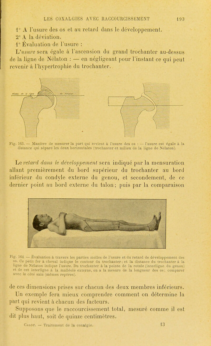 1° A l'usure des os et au retard dans le développement. 2 A la déviation. 1° Évaluation de l'usure : L'usure sera égale à l'ascension du grand trochanter au-dessus de la ligne de Nélaton : — en négligeant pour l'instant ce qui peut revenir à l'hypertrophie du trochanter. distance qui sépare les deux horizontales (trochanter et milieu de la ligne do Nélaton). Le retard dans le développement sera indiqué par la mensuration allant premièrement du bord supérieur du trochanter au bord inférieur du condyle externe du genou, et secondement, de ce dernier point au bord externe du talon; puis par la comparaison Fig. 161 — Évaluation à travers les parties molles de l'usure et du retard de développement des os. Ce petit fer à cheval indique le contour du trochanter; et la distance du trochanter à la ligna de Nélaton indique l'usure. Du trochanter à la pointe do la rotulo (interligne du genou) et do cet interligne à la malléole externe, on a la mesure do la longueur des os; comparer avec le côté sain (mômes repères). de ces dimensions prises sur chacun des deux membres inférieurs. Un exemple fera mieux comprendre comment on détermine la part qui revient à chacun des facteurs. Supposons que le raccourcissement total, mesuré comme il est dit plus haut, soit de quinze centimètres. Calot. — Traitement do la coxalgie 13